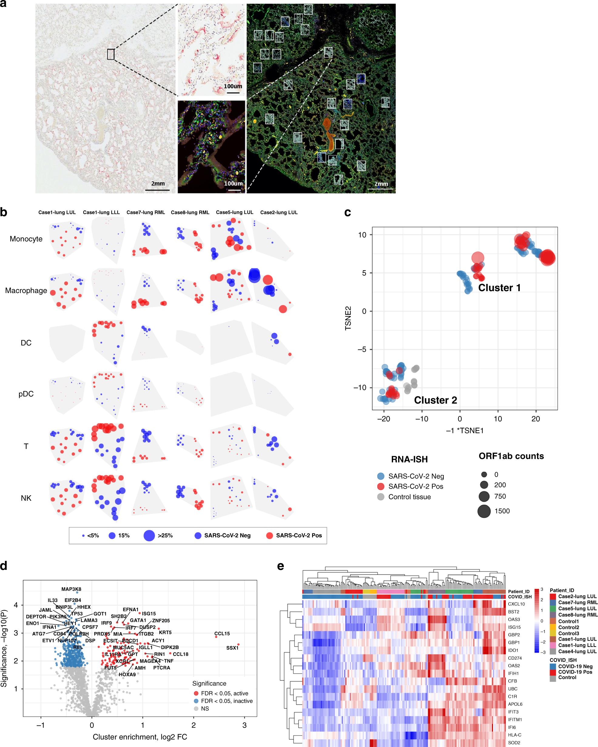 Fig. 6: Intrapulmonary heterogeneity of SARS-CoV-2 host response.