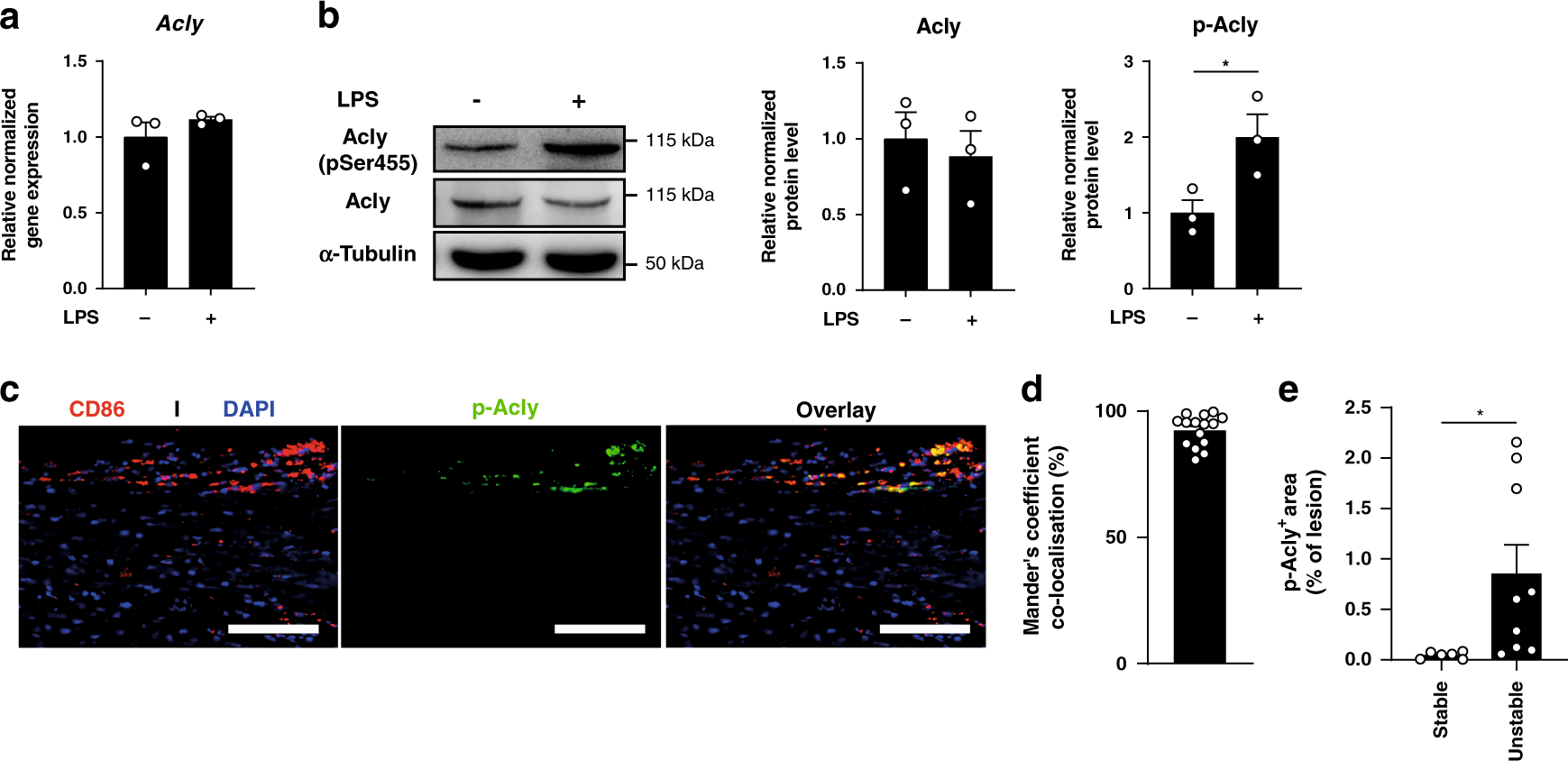 Fig. 1: Acly is phosphorylated in inflammatory conditions in vitro and in vivo.