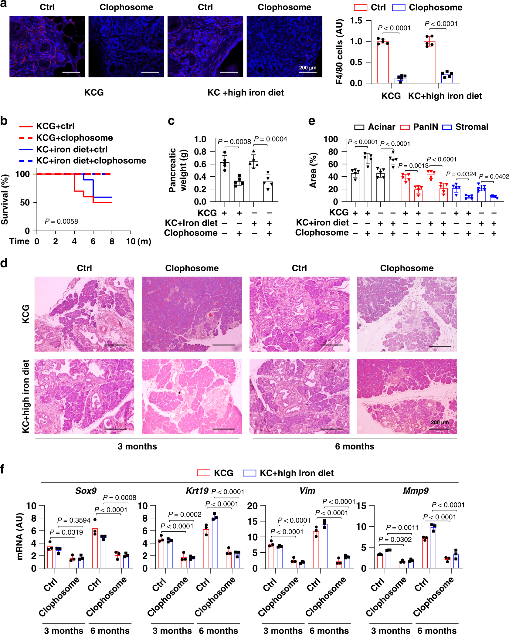 Fig. 3: Macrophage depletion decreases pancreatic tumorigenesis.