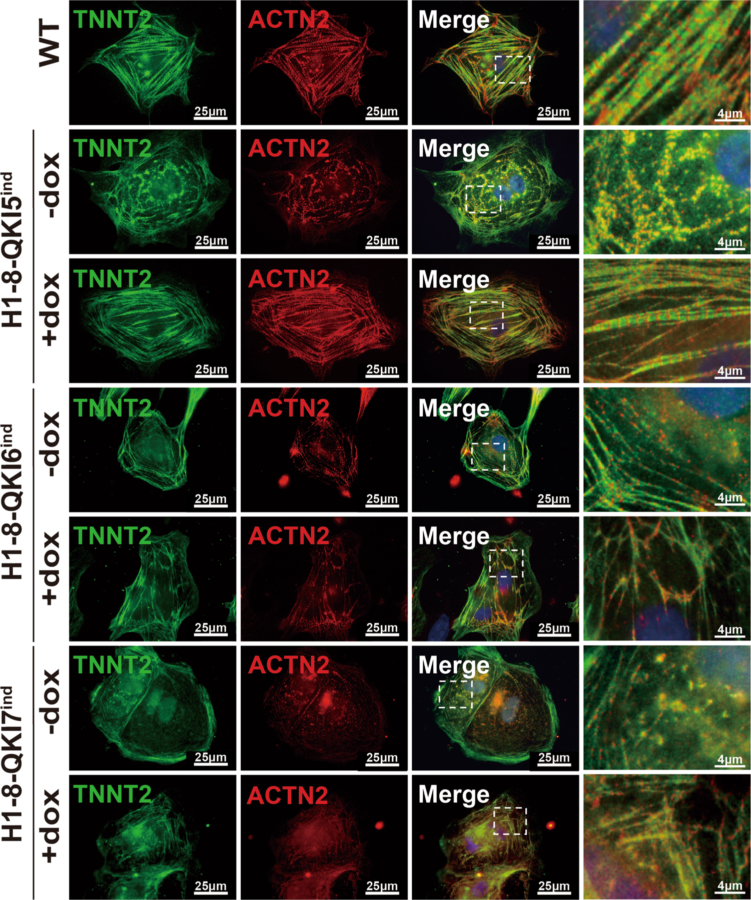 Fig. 8: Reactivation of QKI5 in hESCs-QKIdel rescues myofibrillogenesis.