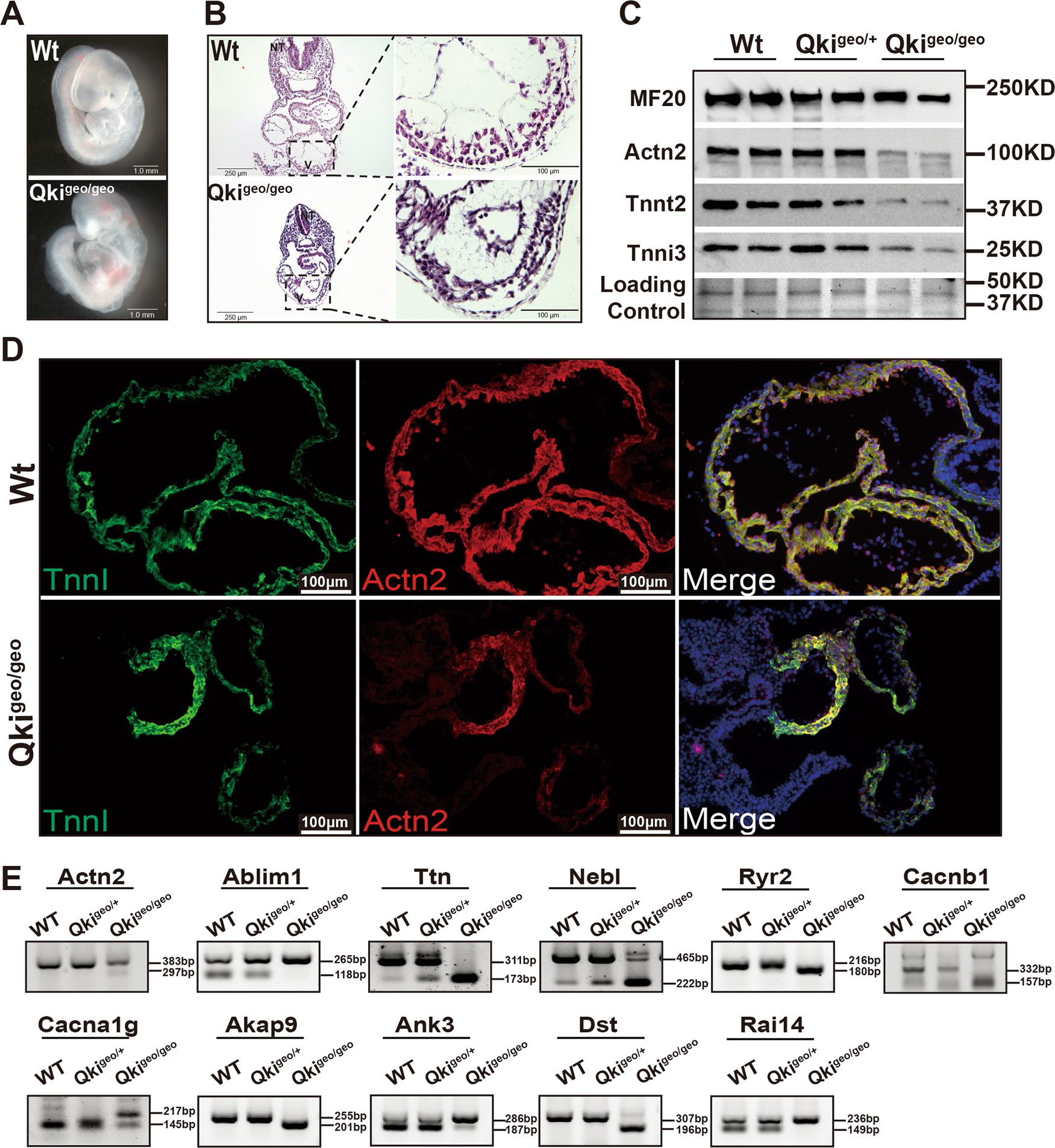 Fig. 9: Defects in myofibrillogenesis in QkiβGeo/βGeo mouse embryonic hearts.