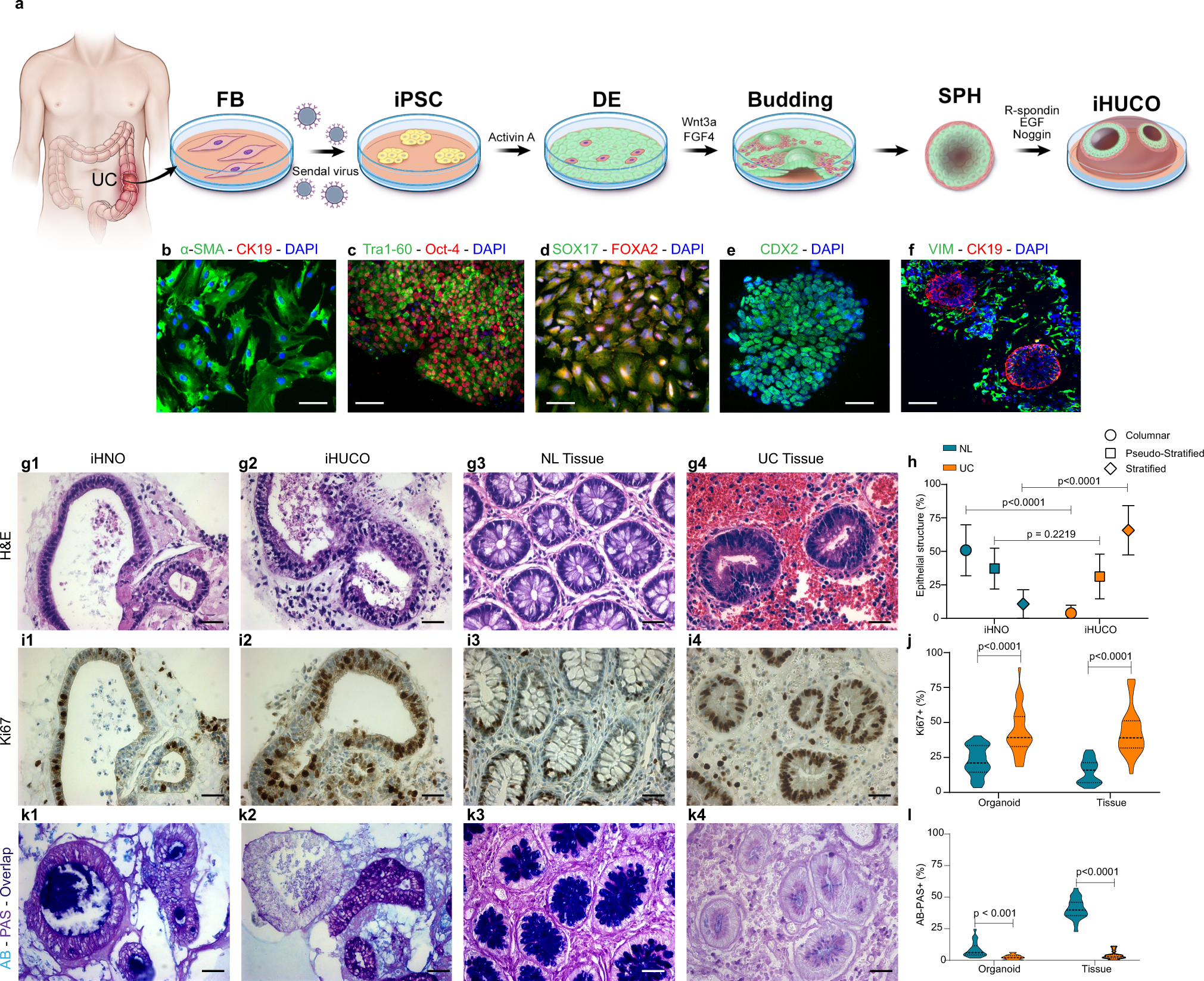 Induced Organoids Derived From Patients With Ulcerative Colitis Recapitulate Colitic Reactivity Nature Communications