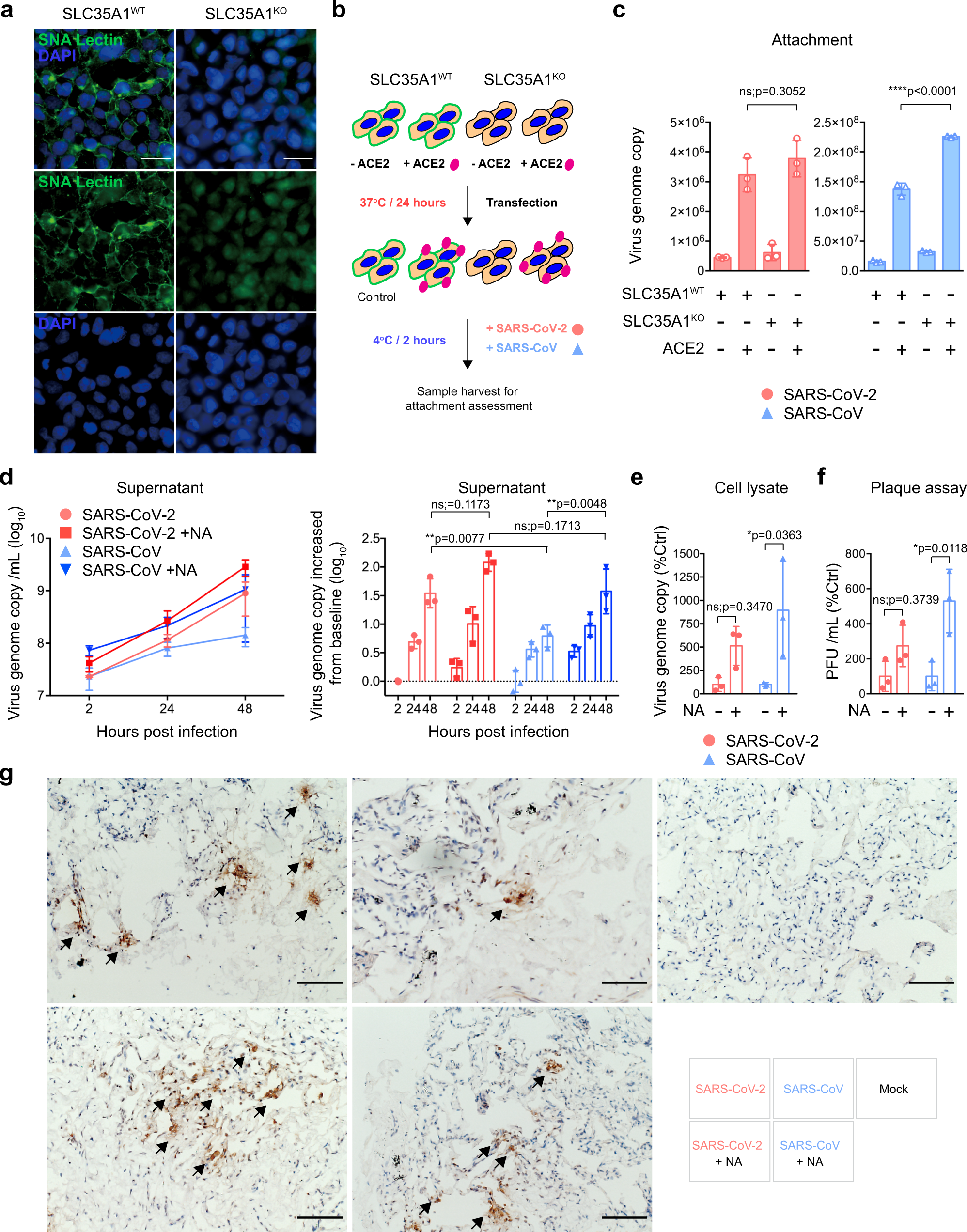 Fig. 3: SARS-CoV-2 partly overcomes sialic acid-mediated restriction in ex vivo human lung tissues.