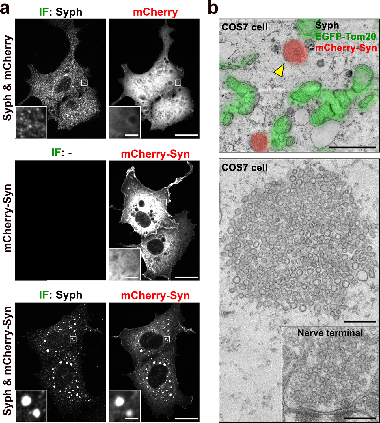 A high magnification image of synapse obtained by electron microscopy