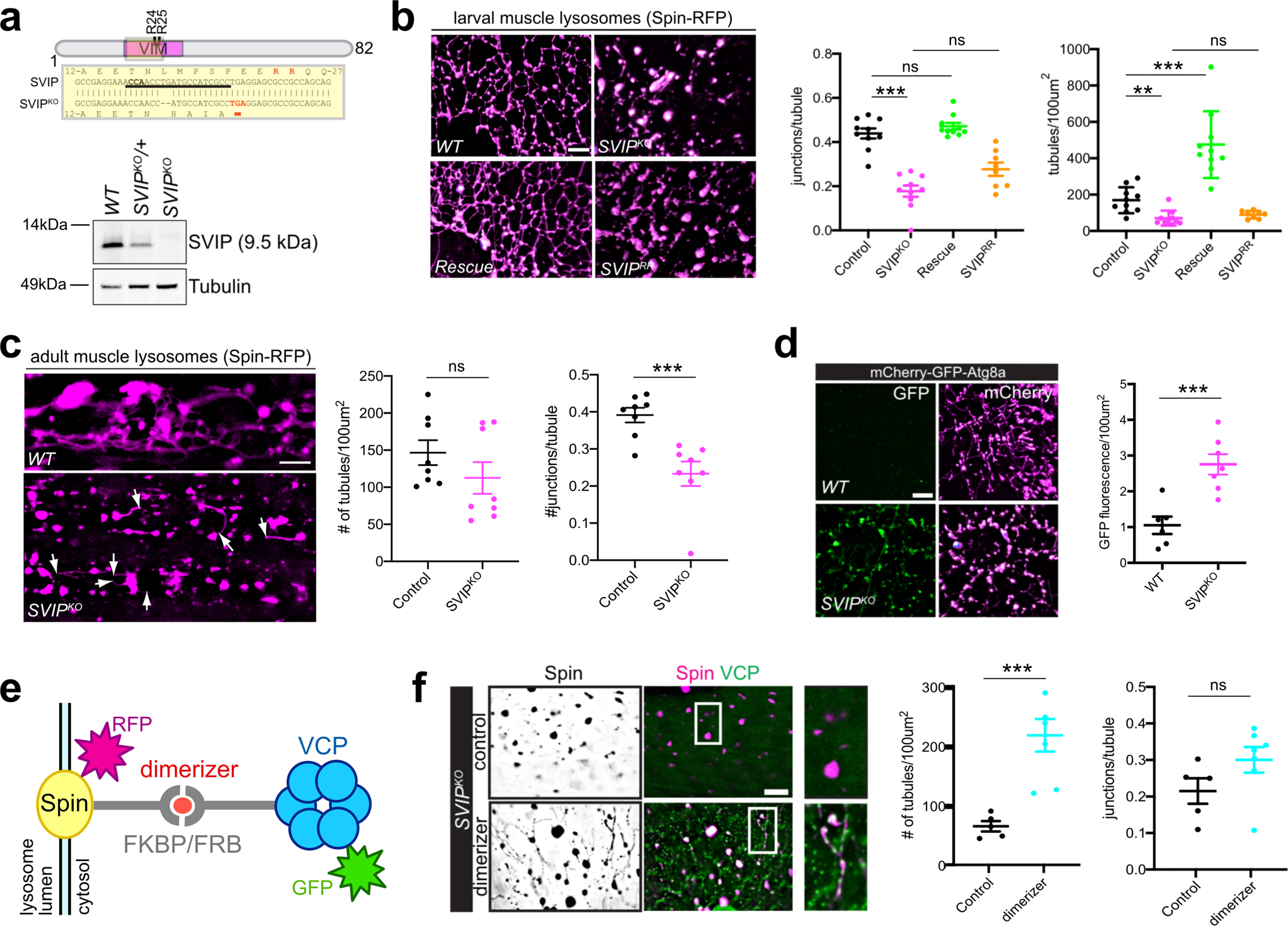 Fig. 2: SVIP-dependent VCP recruitment to lysosomes is required for lysosome integrity and function.