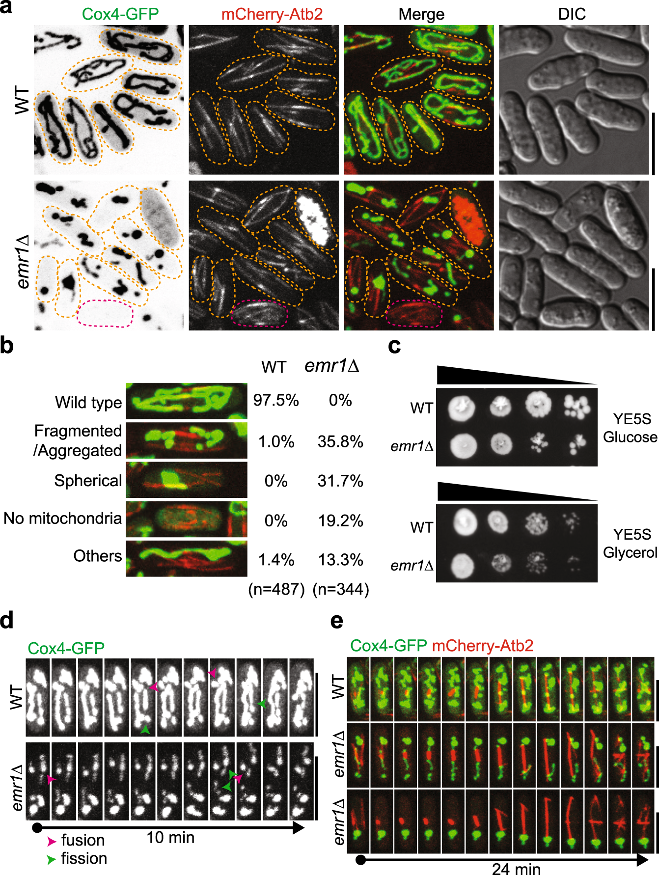 Emr1 regulates the number of foci of the endoplasmic reticulum-mitochondria  encounter structure complex | Nature Communications