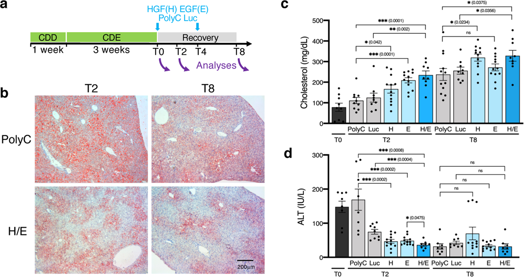 Fig. 4: HGF/EGF mRNA-LNP accelerate restoration of liver function during recovery from CDE-induced chronic liver injury.