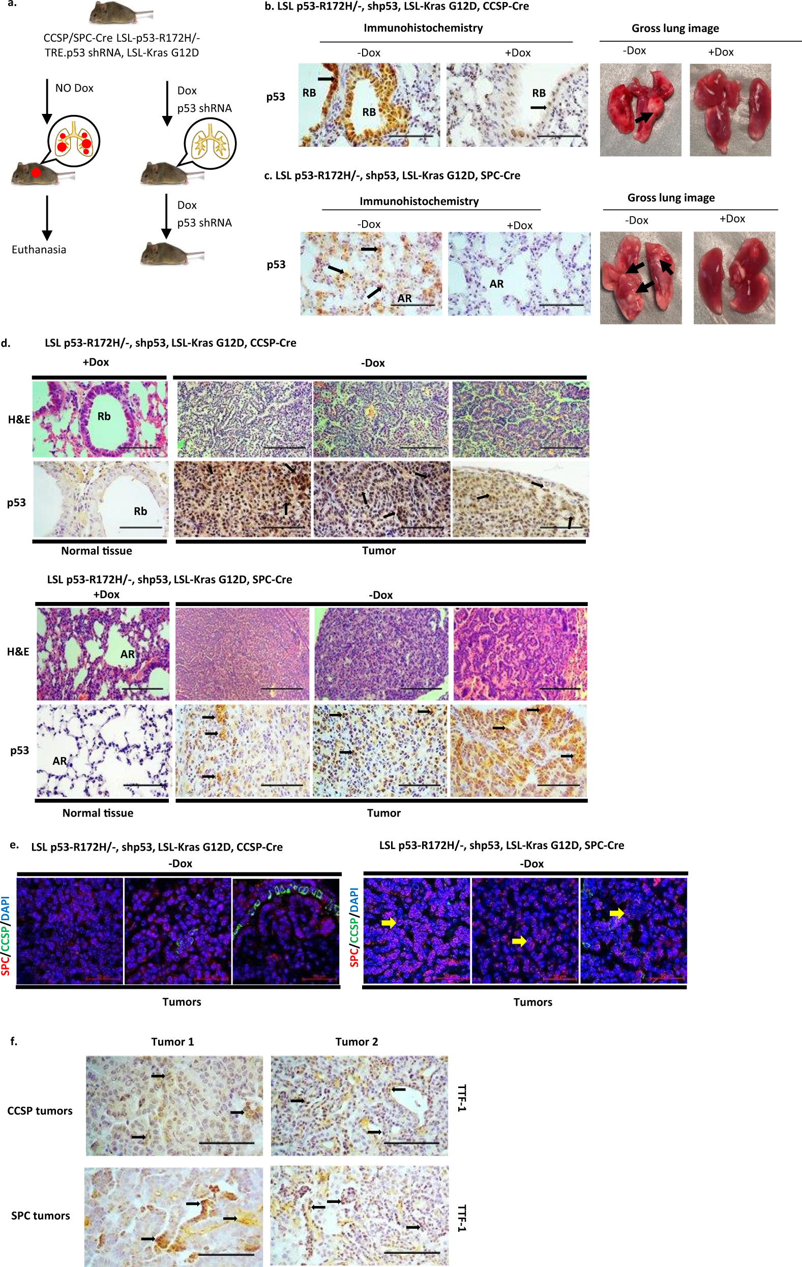 The oncogenicity of tumor-derived mutant p53 is enhanced by the recruitment  of PLK3 | Nature Communications