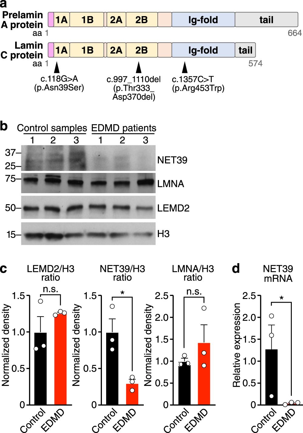 Fig. 4: Net39 is downregulated in EDMD.