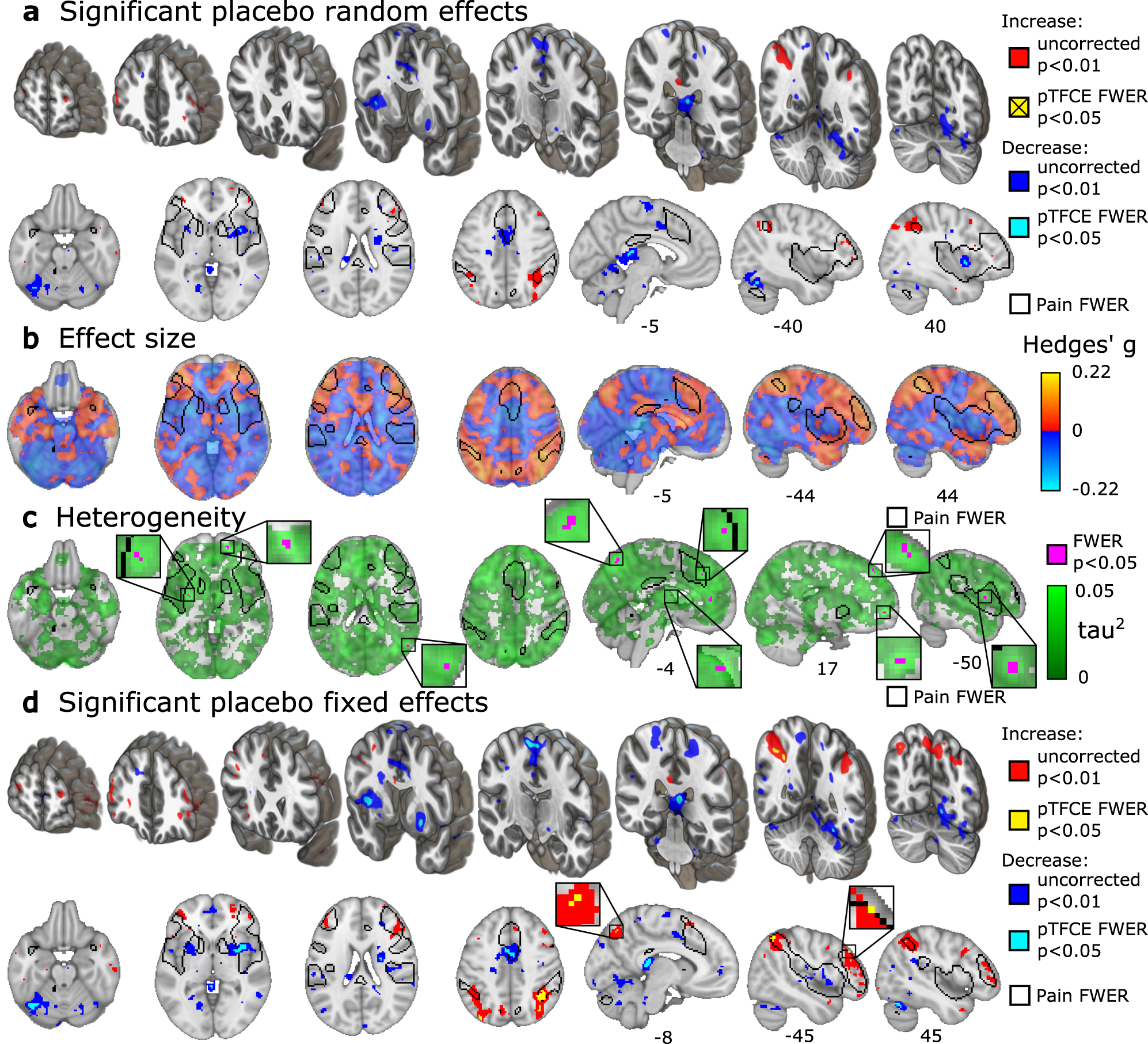 Meta-analysis of Neural Systems in Placebo Analgesia