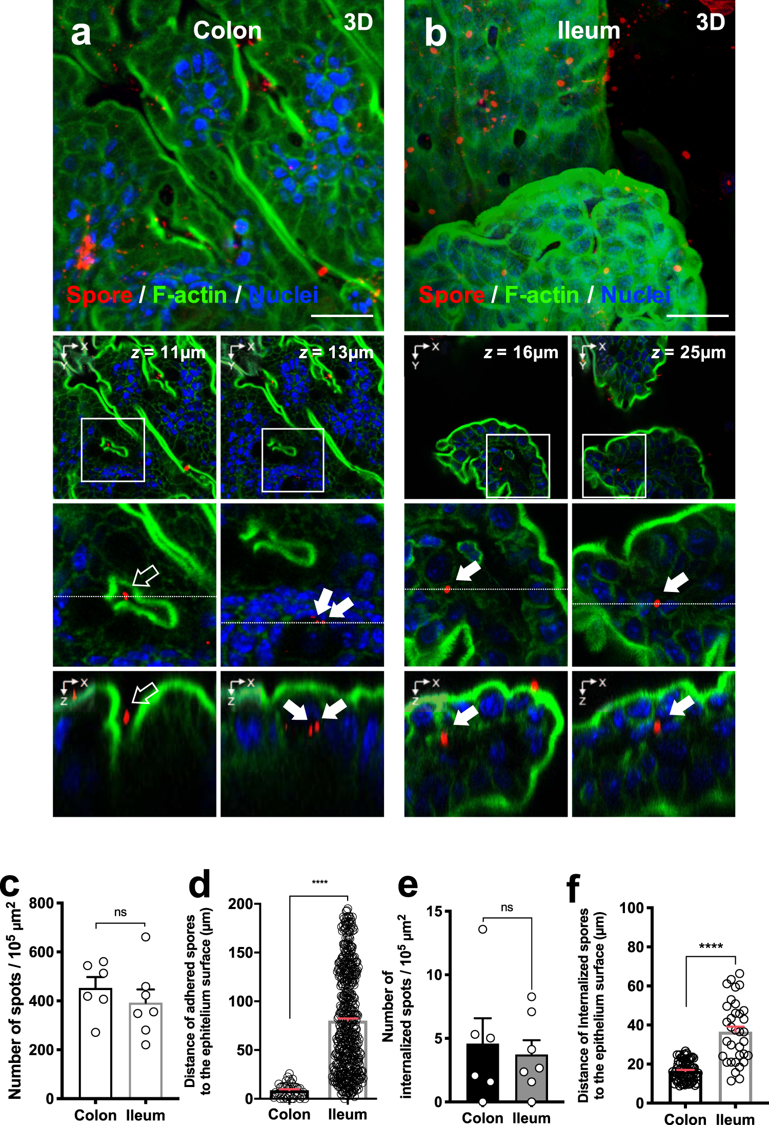 Jane Austen şikayet ediyorum geliştirmek  Entry of spores into intestinal epithelial cells contributes to recurrence  of Clostridioides difficile infection | Nature Communications
