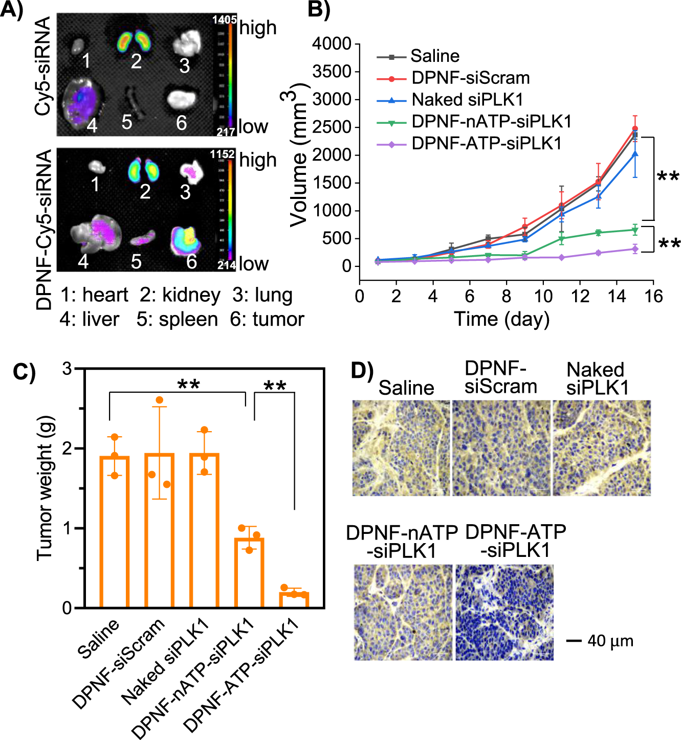 Fig. 7: In vivo targeting ability, antitumor, and gene knockdown effects of siPLK1-loaded DPNF in subcutaneous tumor model.