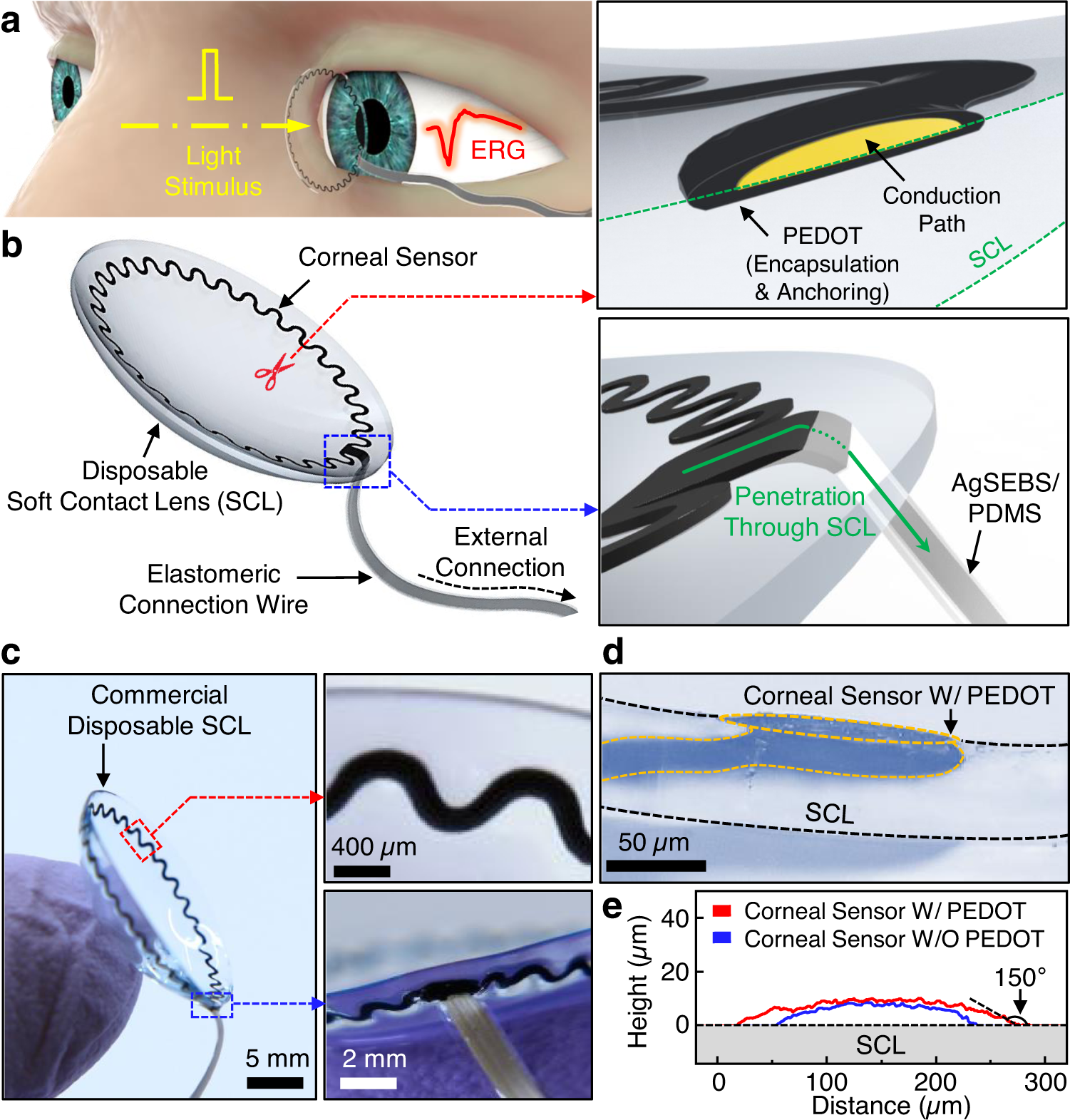 Trouble-shooting the Fit of a Custom Soft Contact Lens