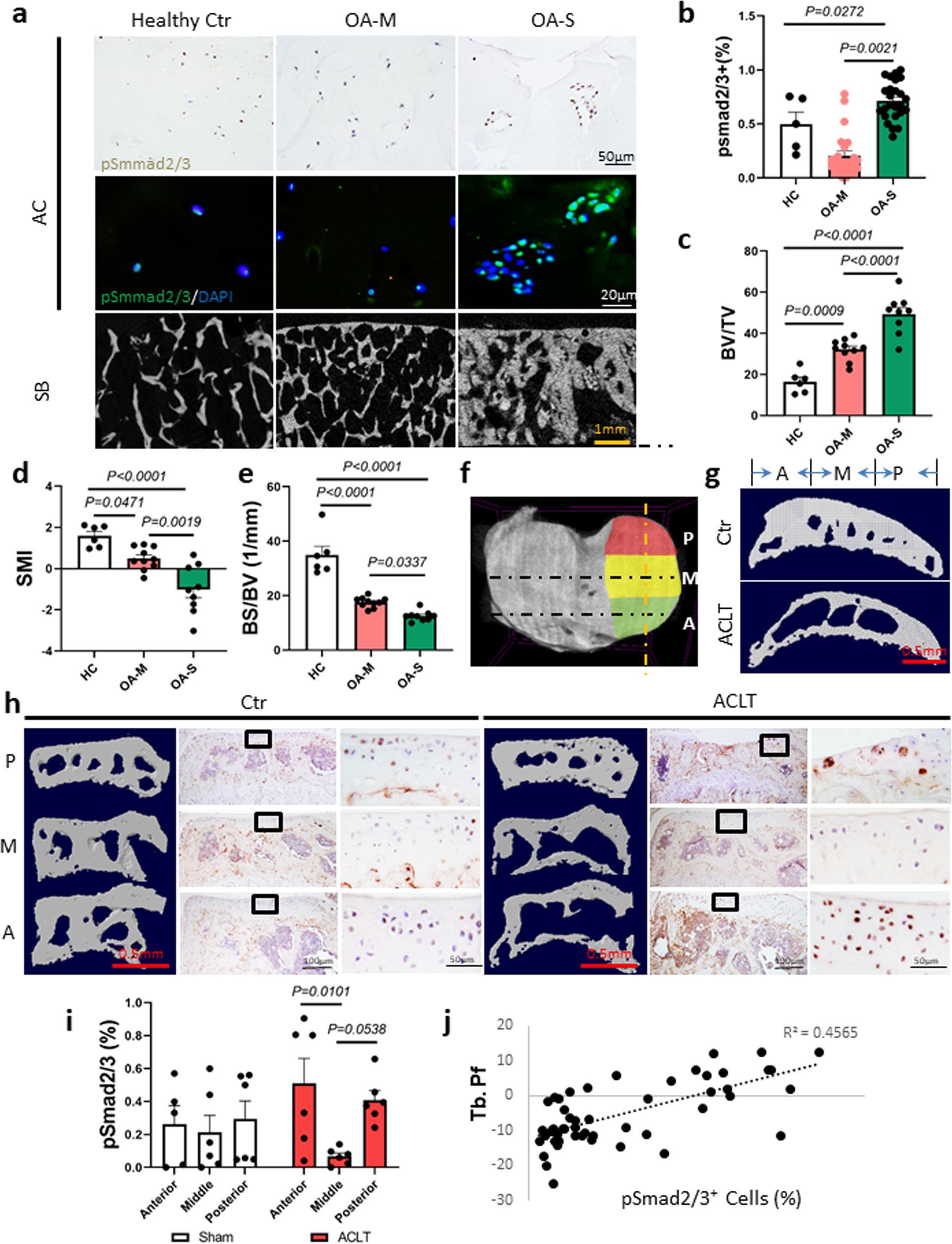 PDF) Excessive mechanical loading promotes osteoarthritis through