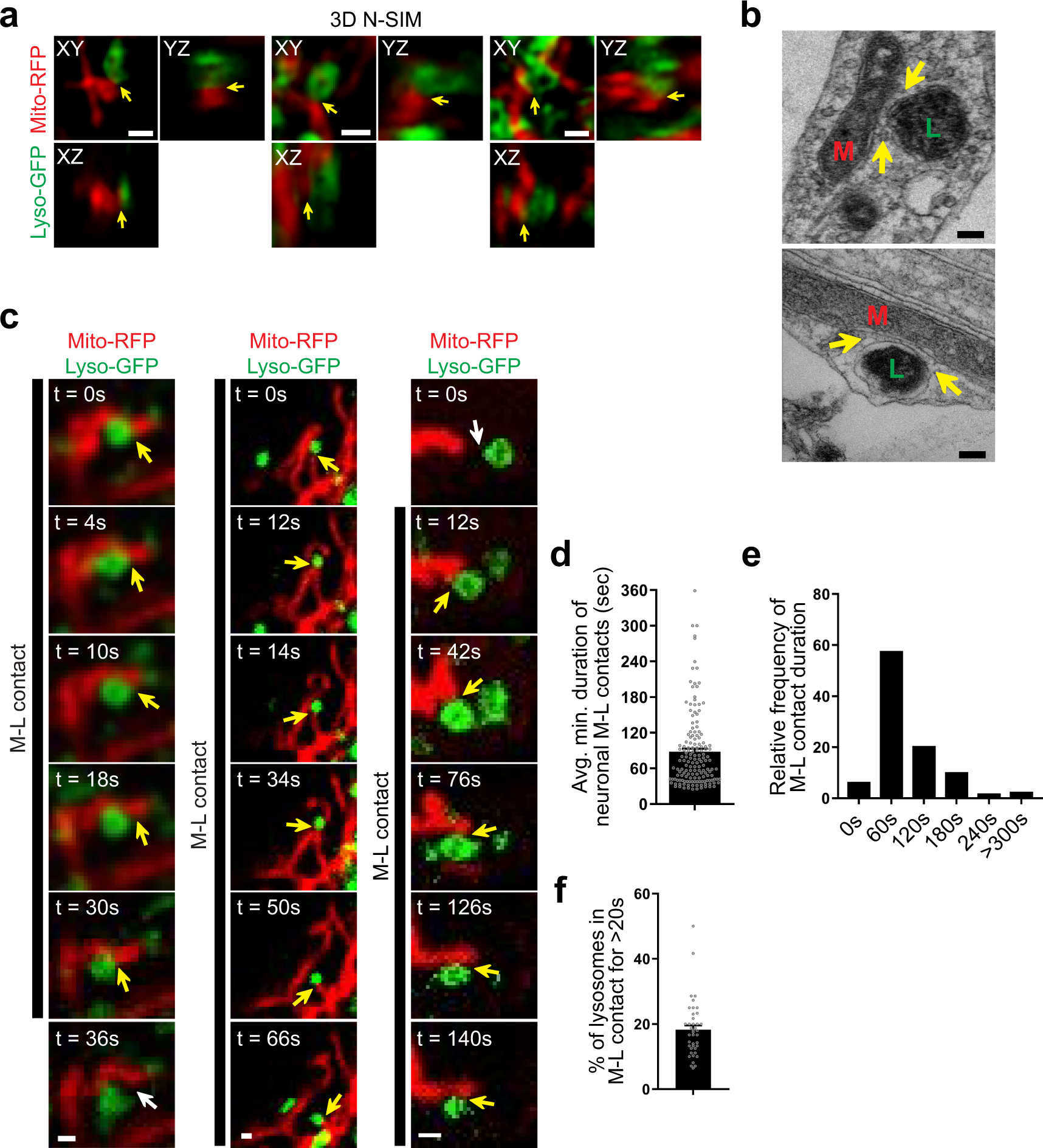 Dysregulation of mitochondria-lysosome contacts by GBA1 dysfunction in  dopaminergic neuronal models of Parkinson's disease | Nature Communications