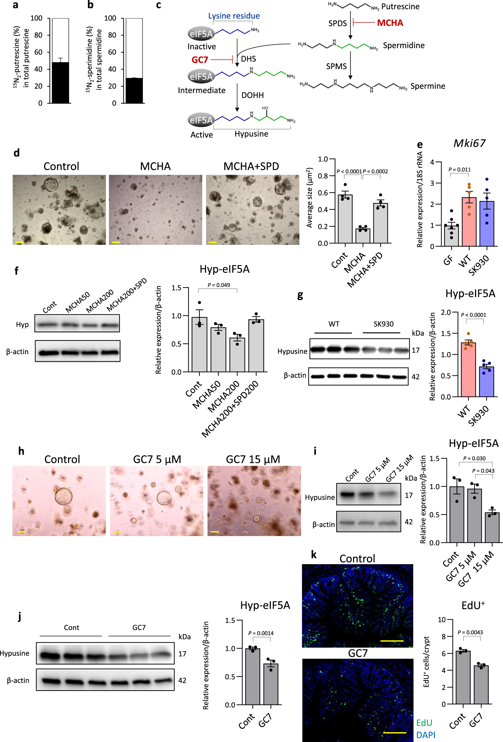 Fig. 2: Inhibition of hypusination of eIF5A arrests colonic organoid growth.