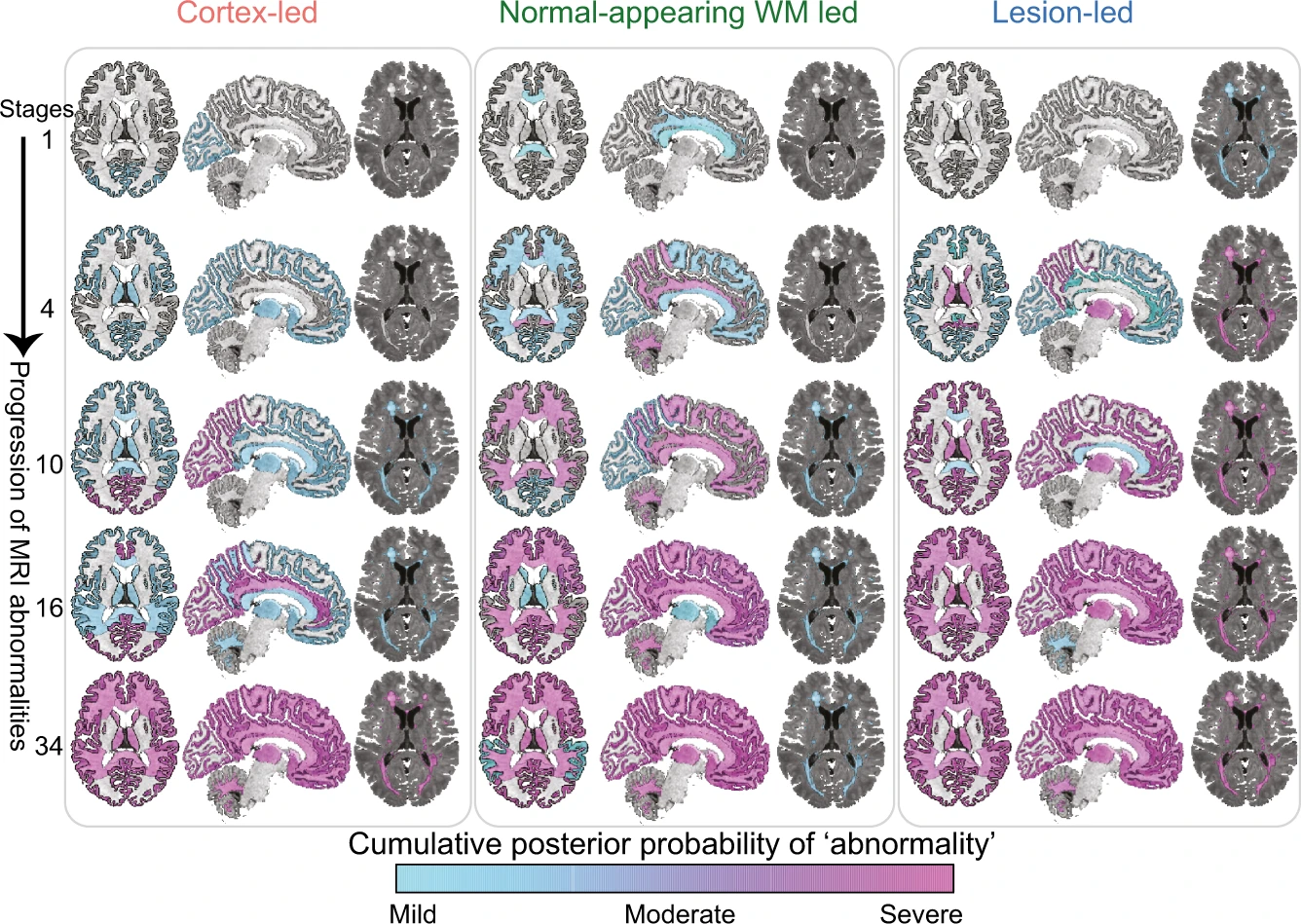 Identifying multiple sclerosis subtypes using unsupervised machine learning and MRI data