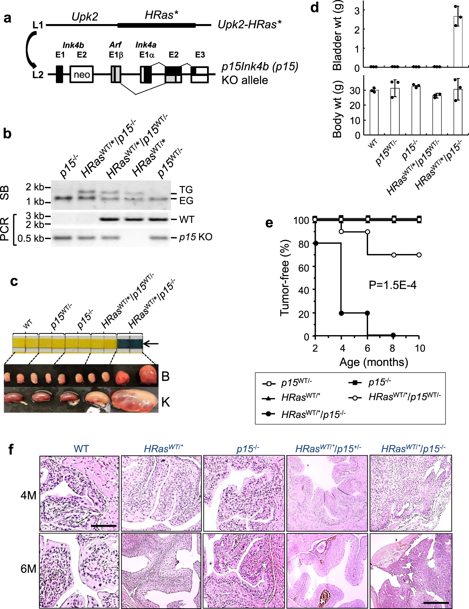 Fig. 1: Loss of p15 in mouse urothelial cells expressing oncogenic HRas triggers early-onset and highly penetrant urothelial carcinomas that strongly resemble low-grade, papillary, non-muscle-invasive bladder cancer in humans.