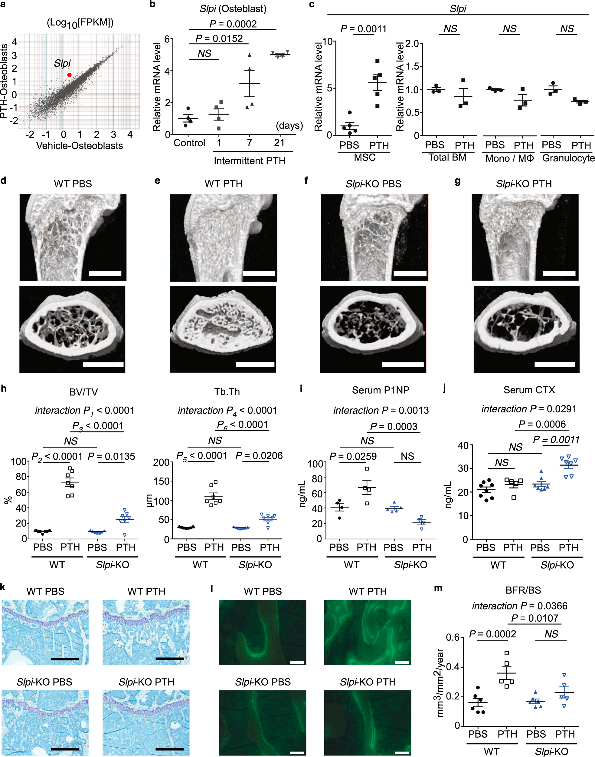 SLPI is a critical mediator that controls PTH-induced bone formation |  Nature Communications