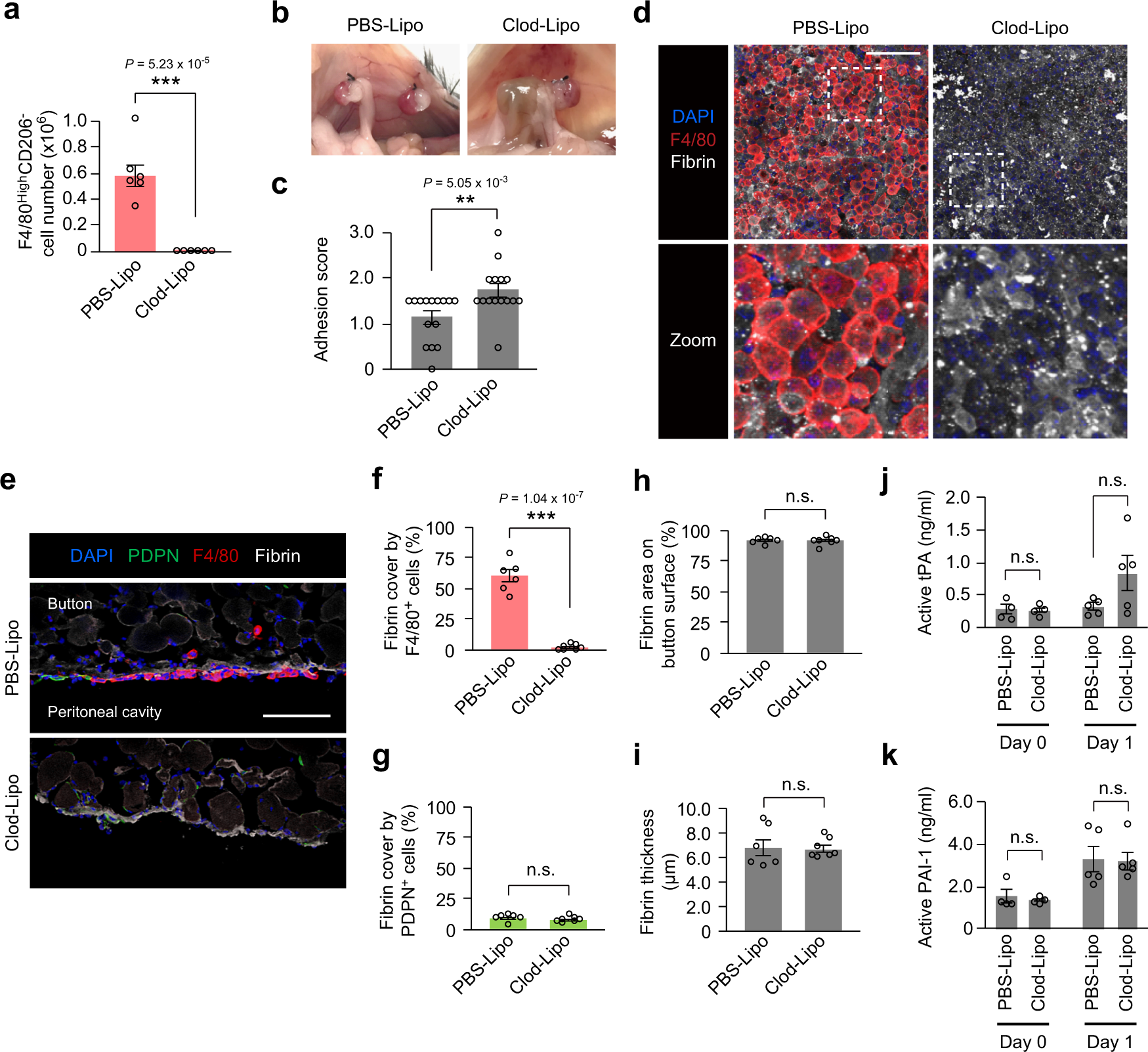 Fig. 4: Depletion of resident F4/80HighCD206− peritoneal macrophages exacerbates post-operative abdominal adhesion formation.