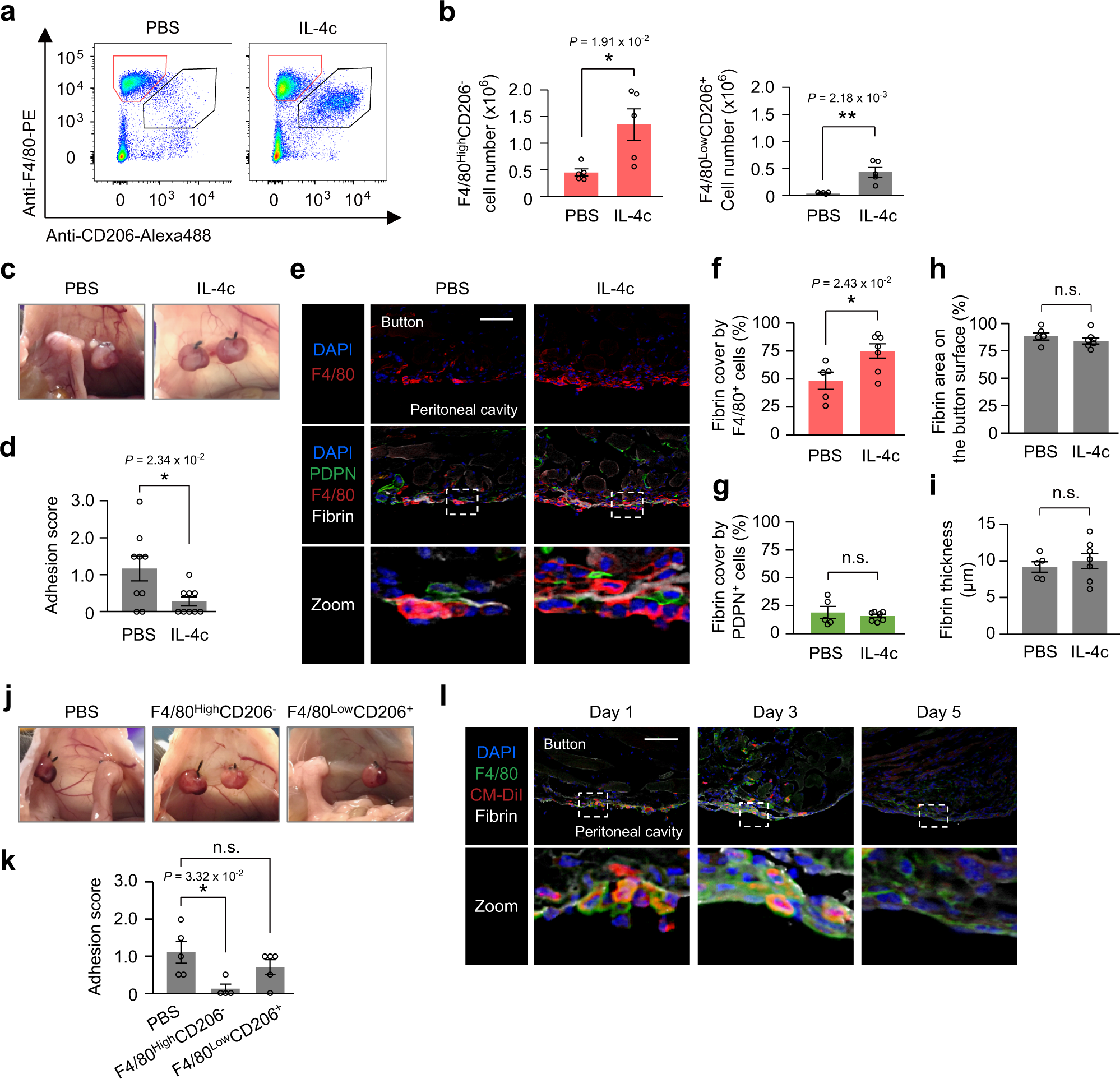 Fig. 6: IL-4c administration augments the macrophage barrier and attenuates post-operative adhesion formation.