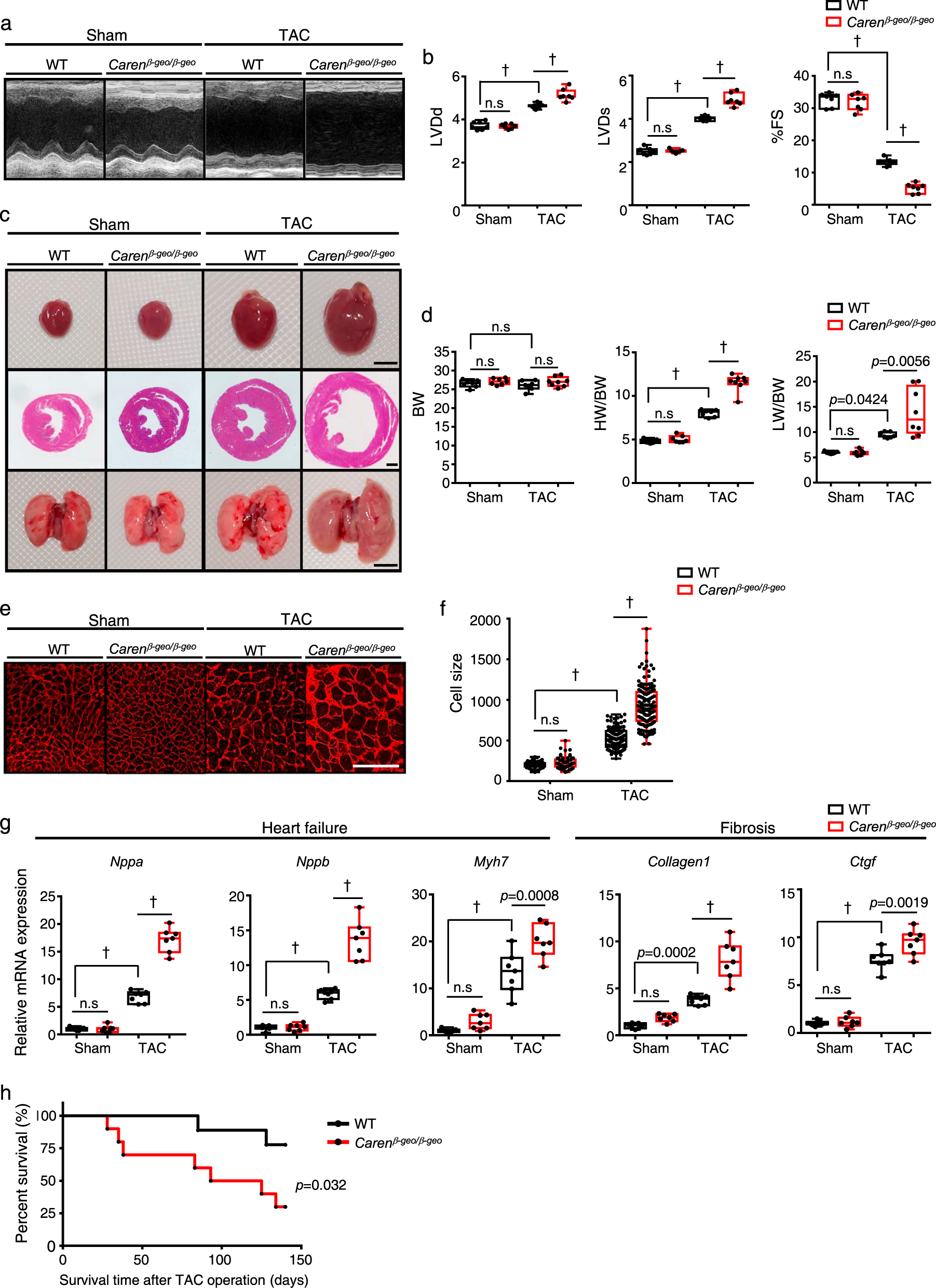 Fig. 2: Caren deficiency accelerates cardiac dysfunction in a mouse HF model.