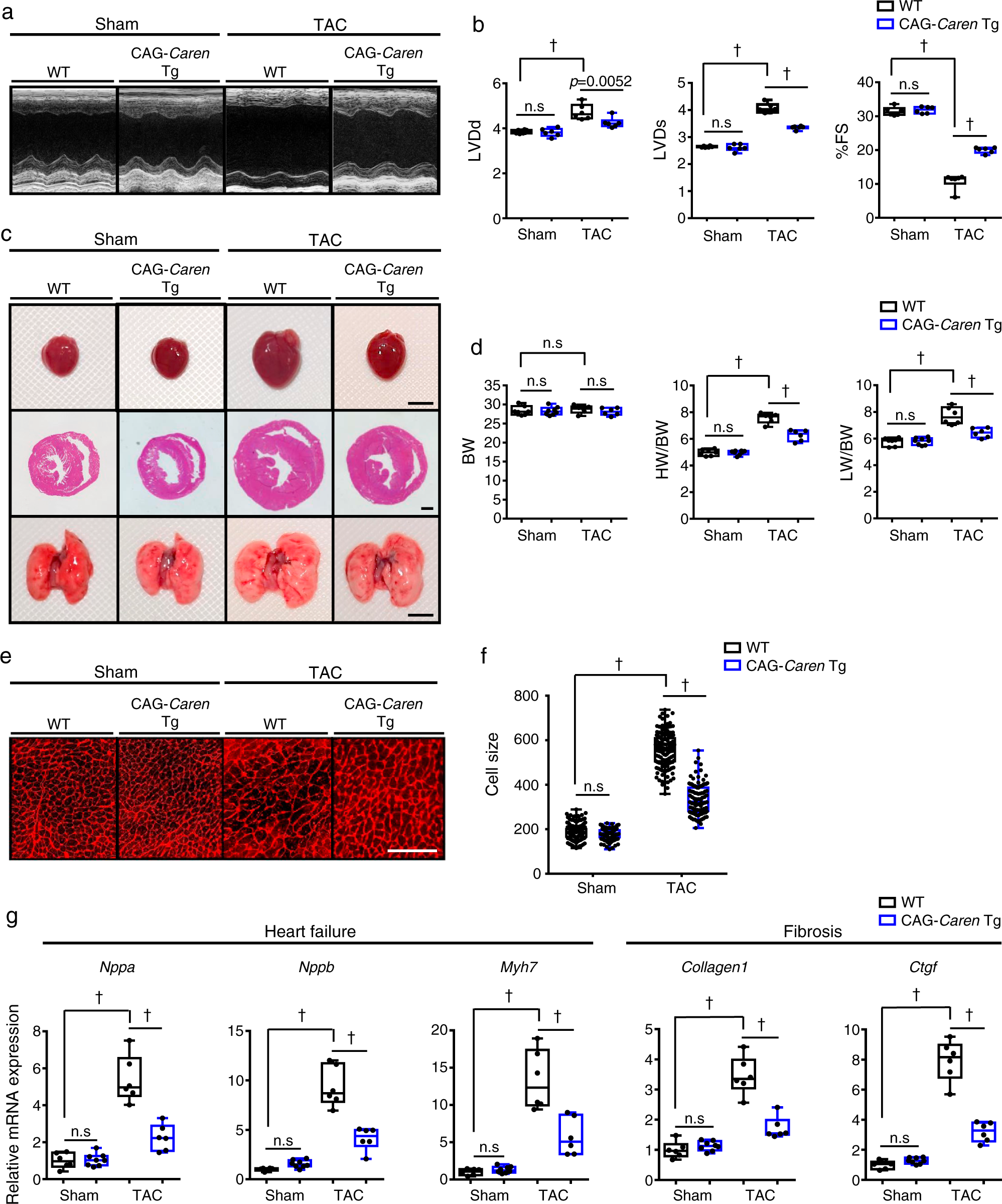 Fig. 3: Mice overexpressing Caren in cardiomyocytes resist HF development.