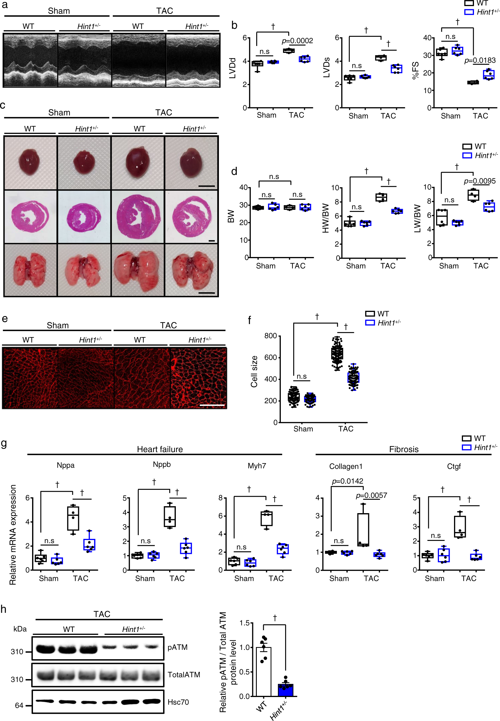 Fig. 7: Hint1-deficient mice are resistant to HF development.