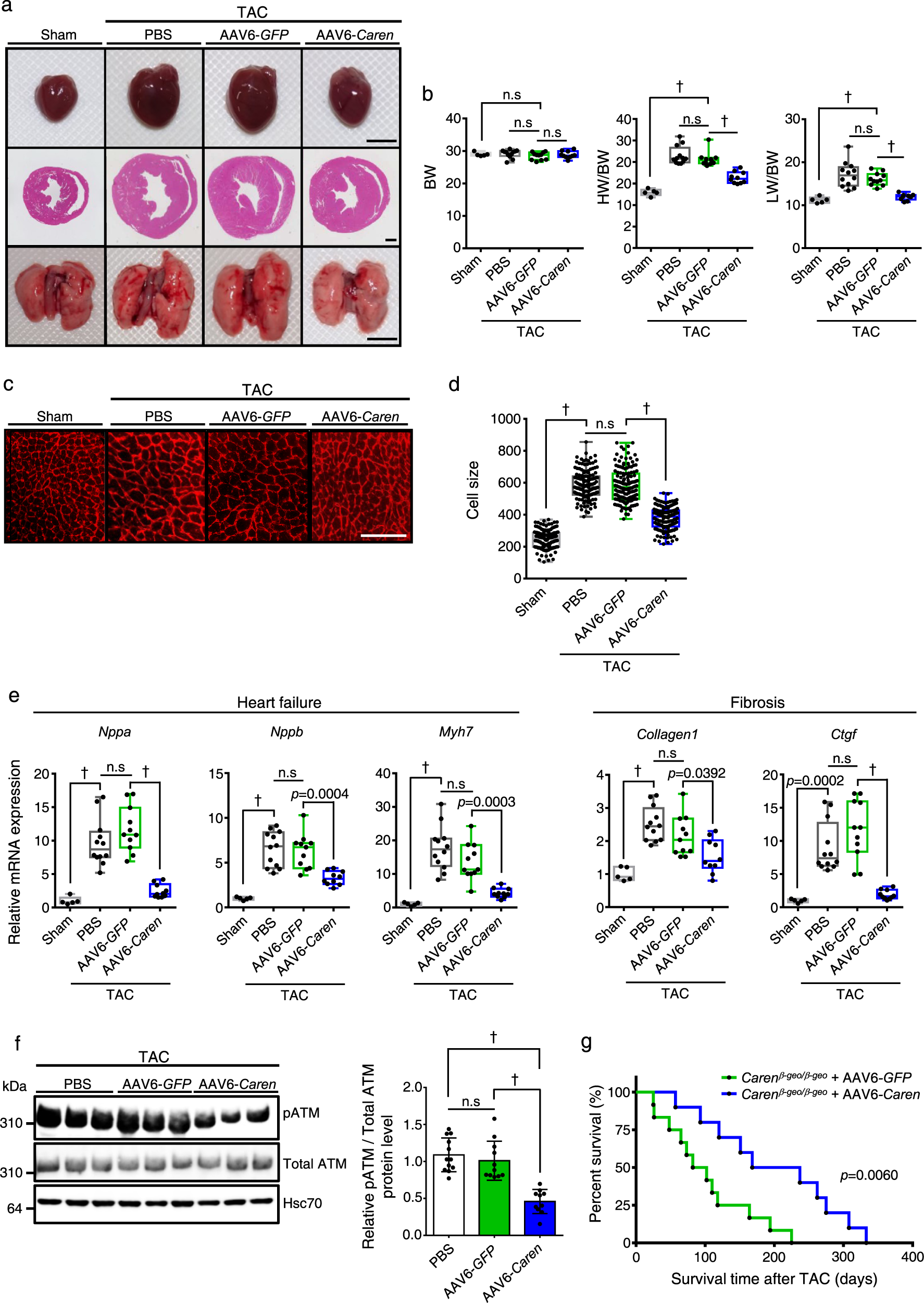 Fig. 9: Intravenous injection of AAV6-Caren suppresses myocardial remodeling in mice subjected to pressure overload.