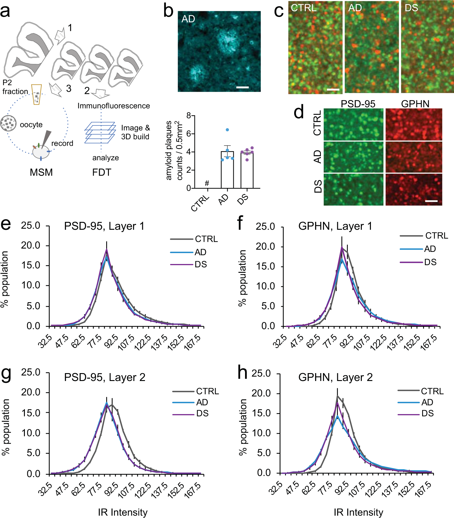 Location and distribution of inhibitory synapses differentially affect