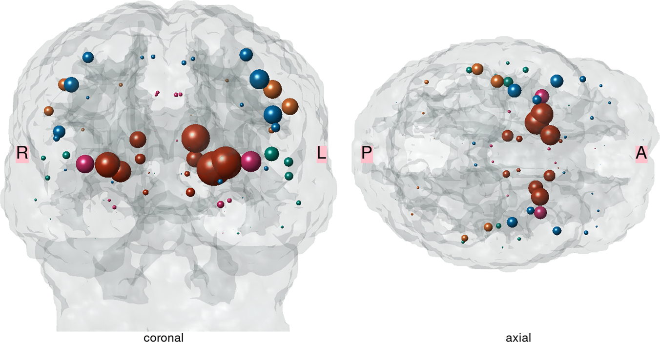 Preserved Structural Connectivity Mediates The Clinical Effect Of Thrombolysis In Patients With Anterior Circulation Stroke Nature Communications