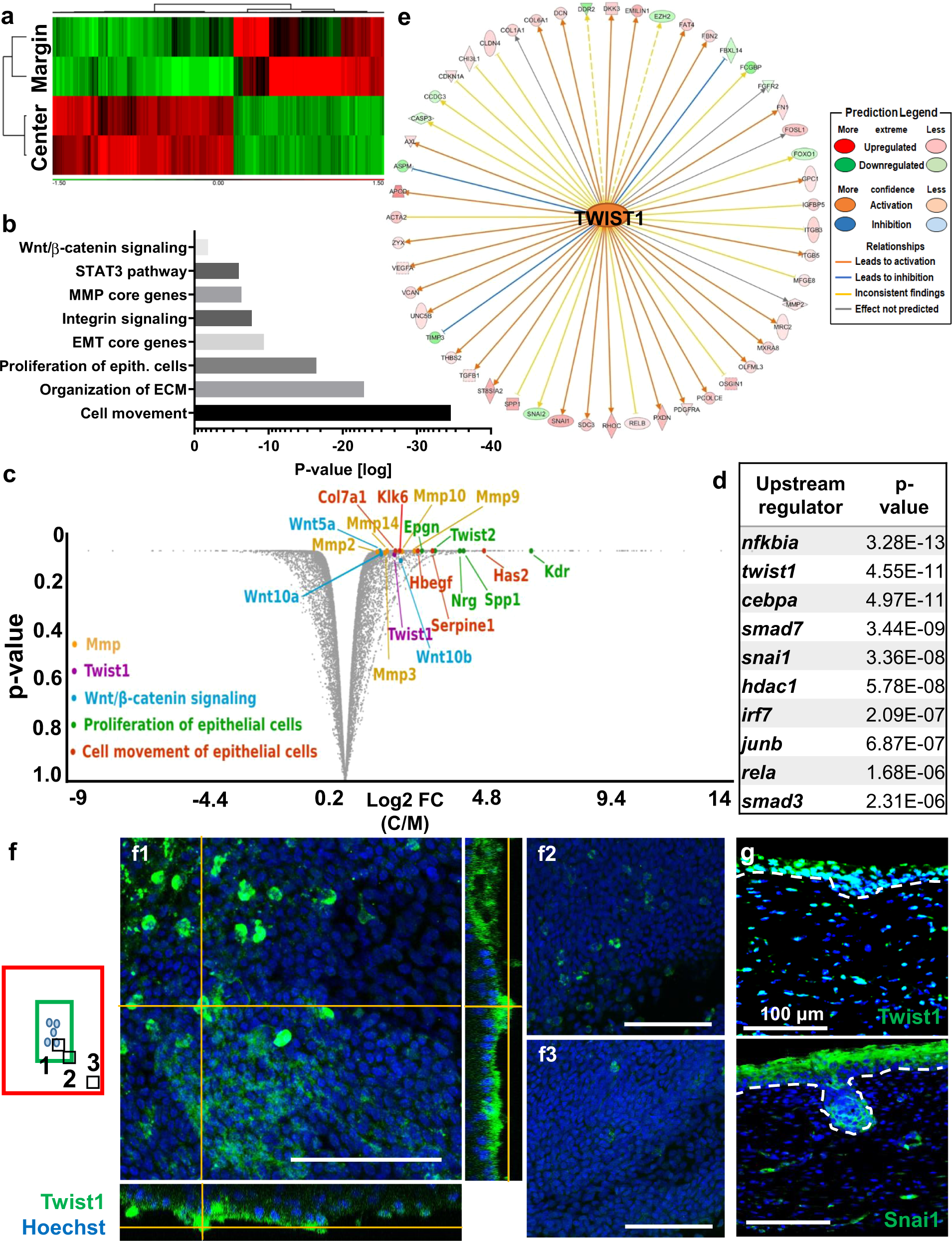 Fig. 3: Transcriptome analysis identifies Twist1 as an important transcription factor during WIHN in laboratory mice.