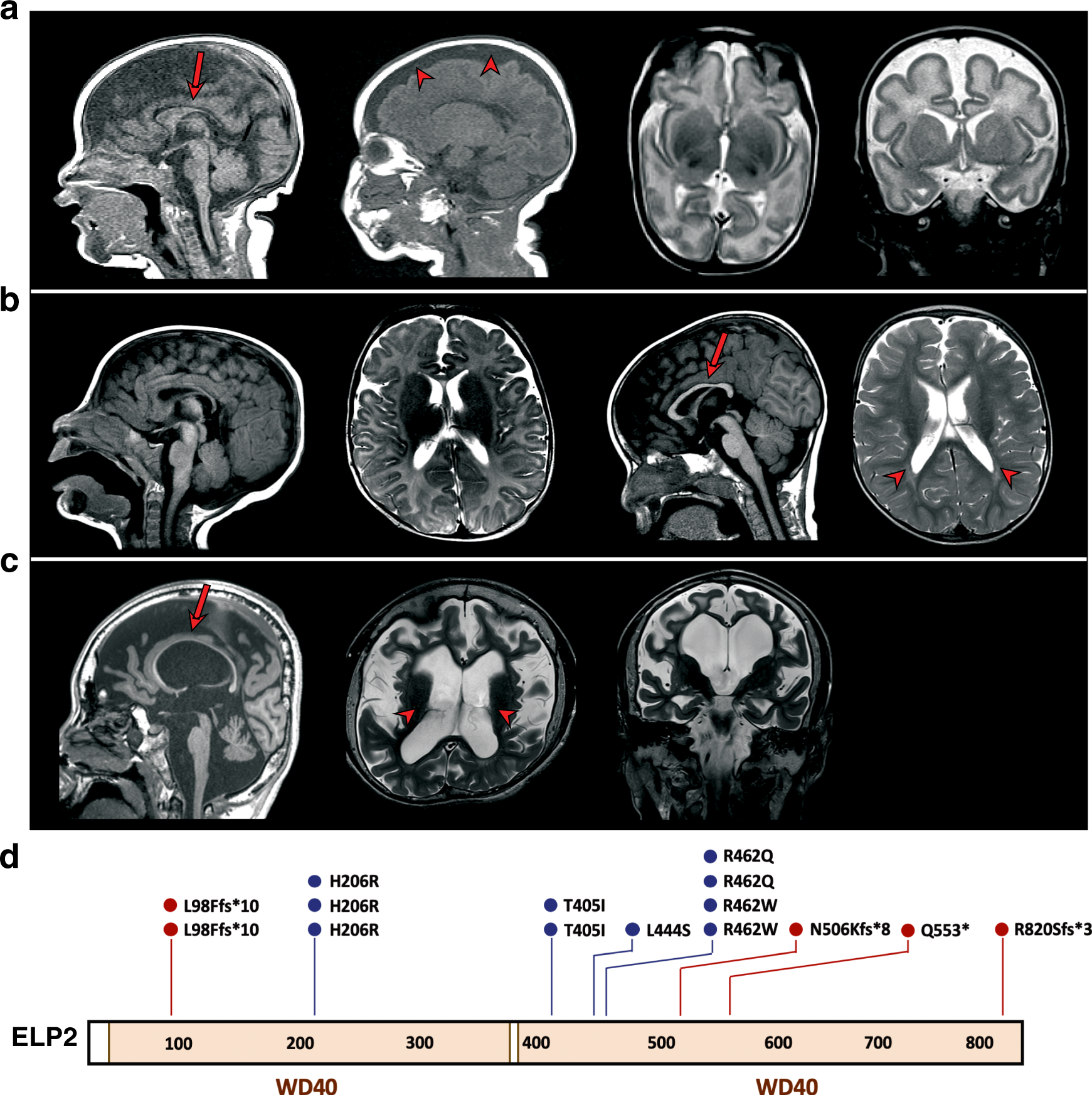 Elp2 Mutations Perturb The Epitranscriptome And Lead To A Complex Neurodevelopmental Phenotype Nature Communications Elp2 Mutations Perturb The Epitranscriptome And Lead To A Complex Neurodevelopmental Phenotype Nature Communications
