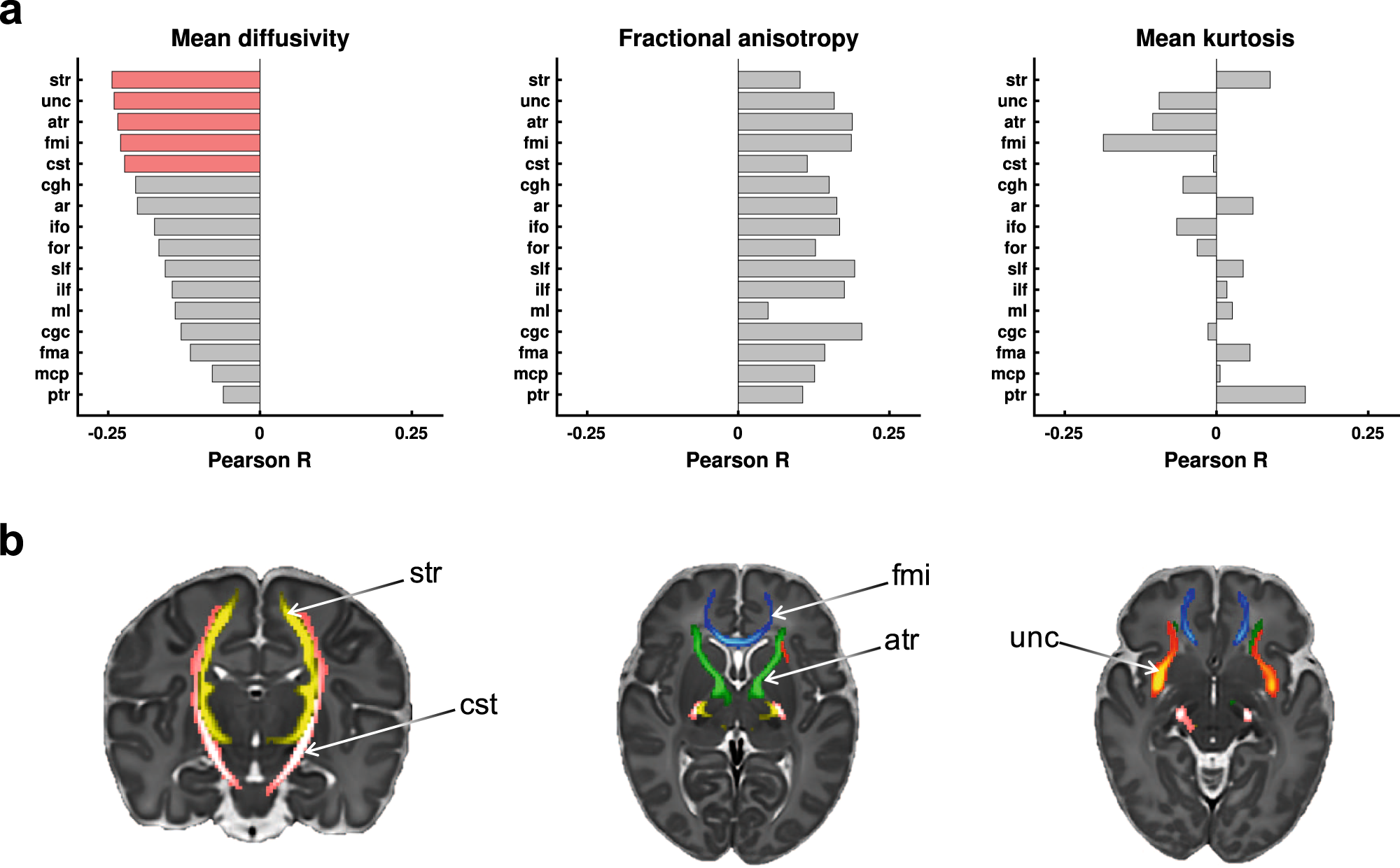 Fig. 5: Exploration of structure-function associations in the dHCP dataset.
