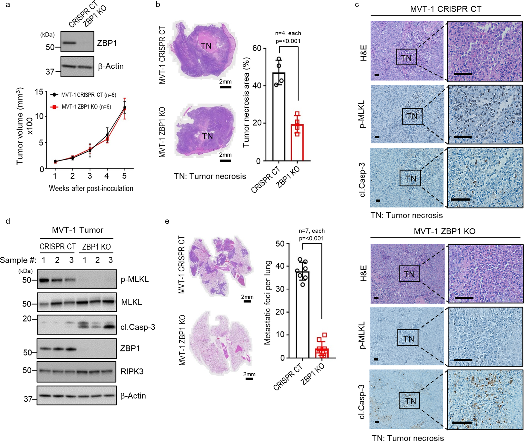 Fig. 3: ZBP1 is critical for tumor necroptosis and lung metastasis.