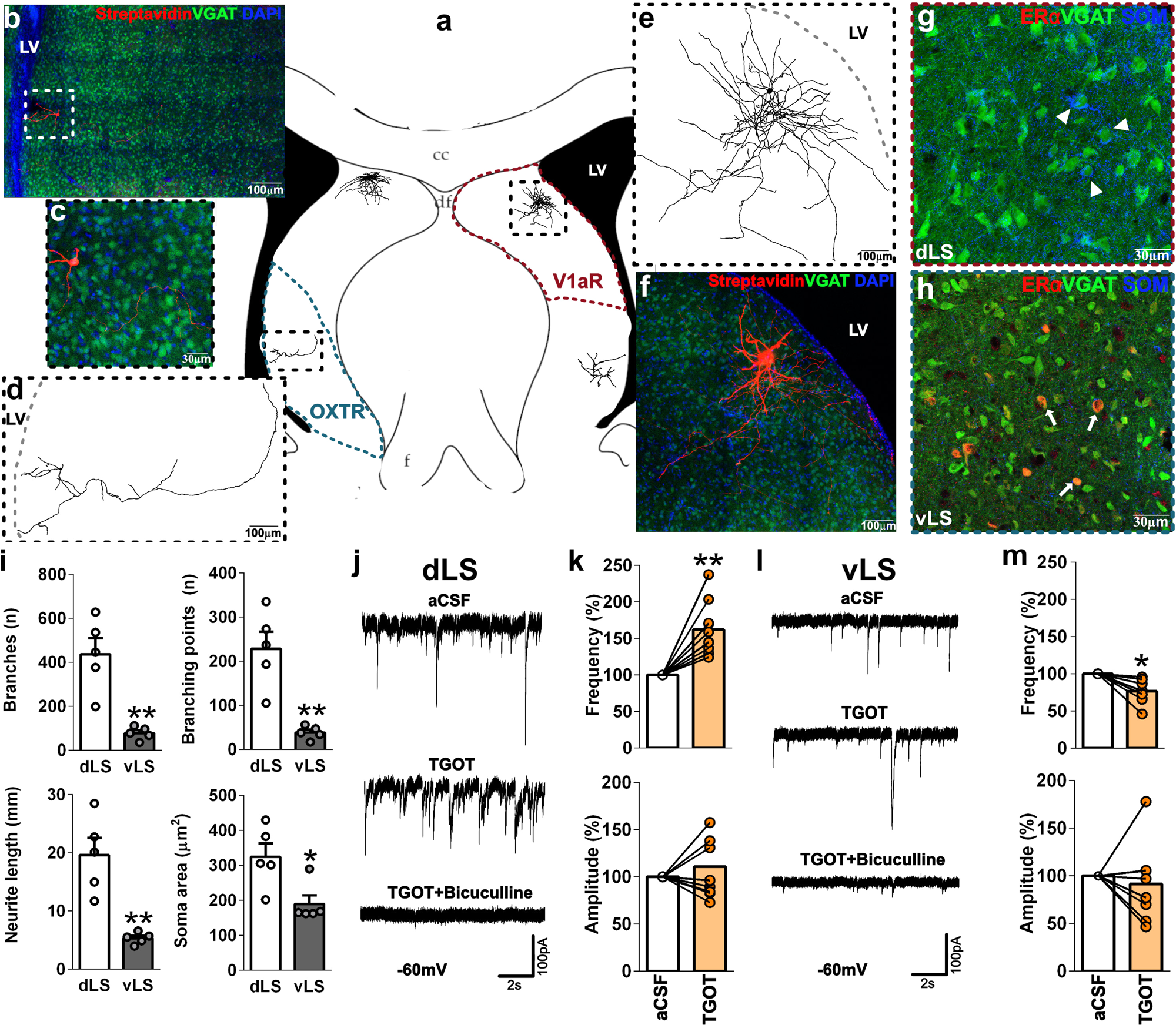 Fig. 6: Spontaneous activity in neurons of the dLS and vLS is differentially modulated by activation of OXTRs.