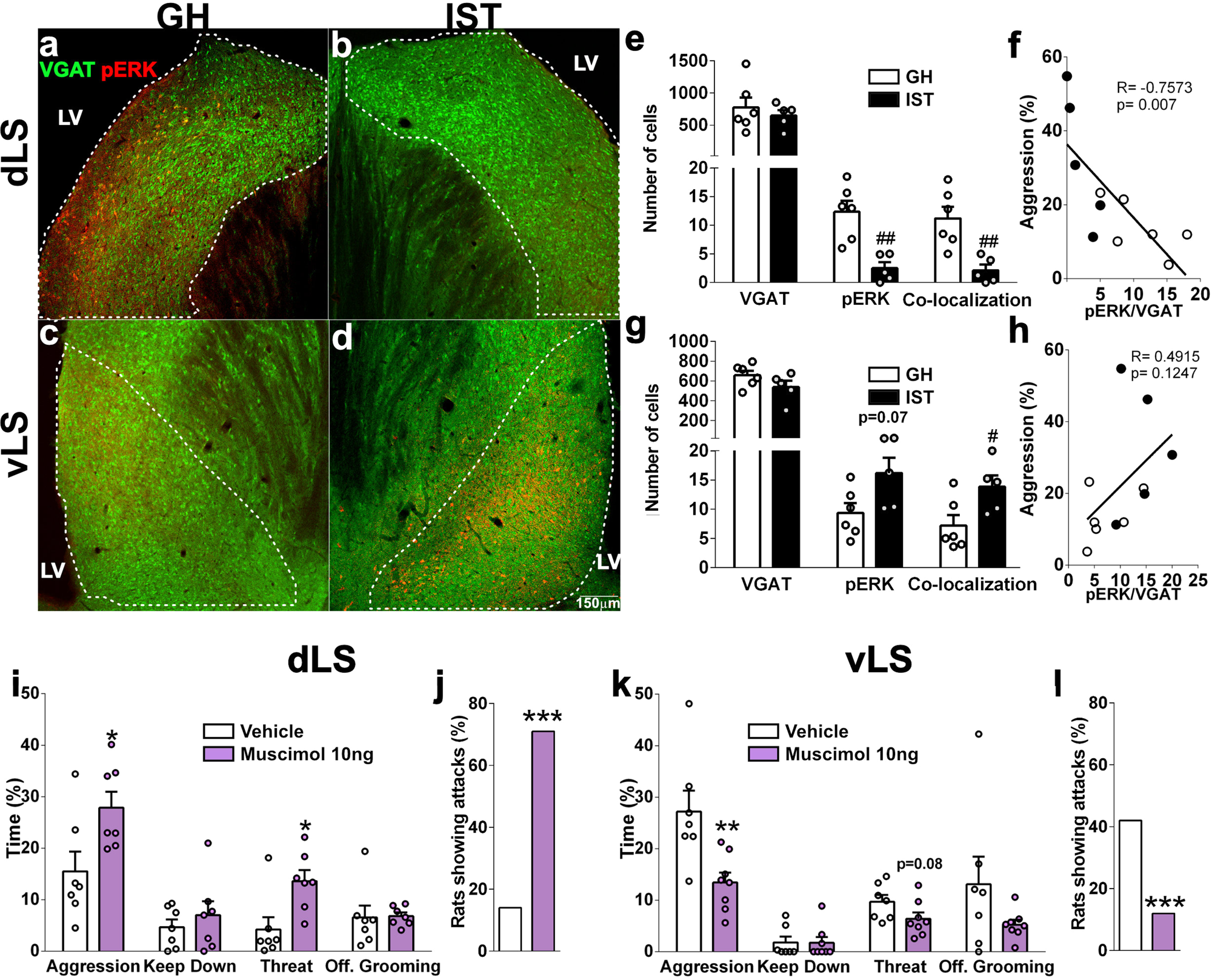Fig. 7: An intrinsic GABAergic circuit within the subregions of the LS regulates aggression in female Wistar rats.
