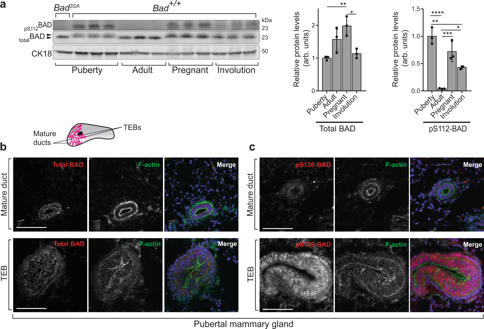 BAD regulates mammary gland morphogenesis by 4E-BP1-mediated control of localized translation in mouse and human models | Nature Communications BAD regulates mammary gland morphogenesis by 4E-BP1-mediated control of localized translation in mouse and human models | Nature Communications