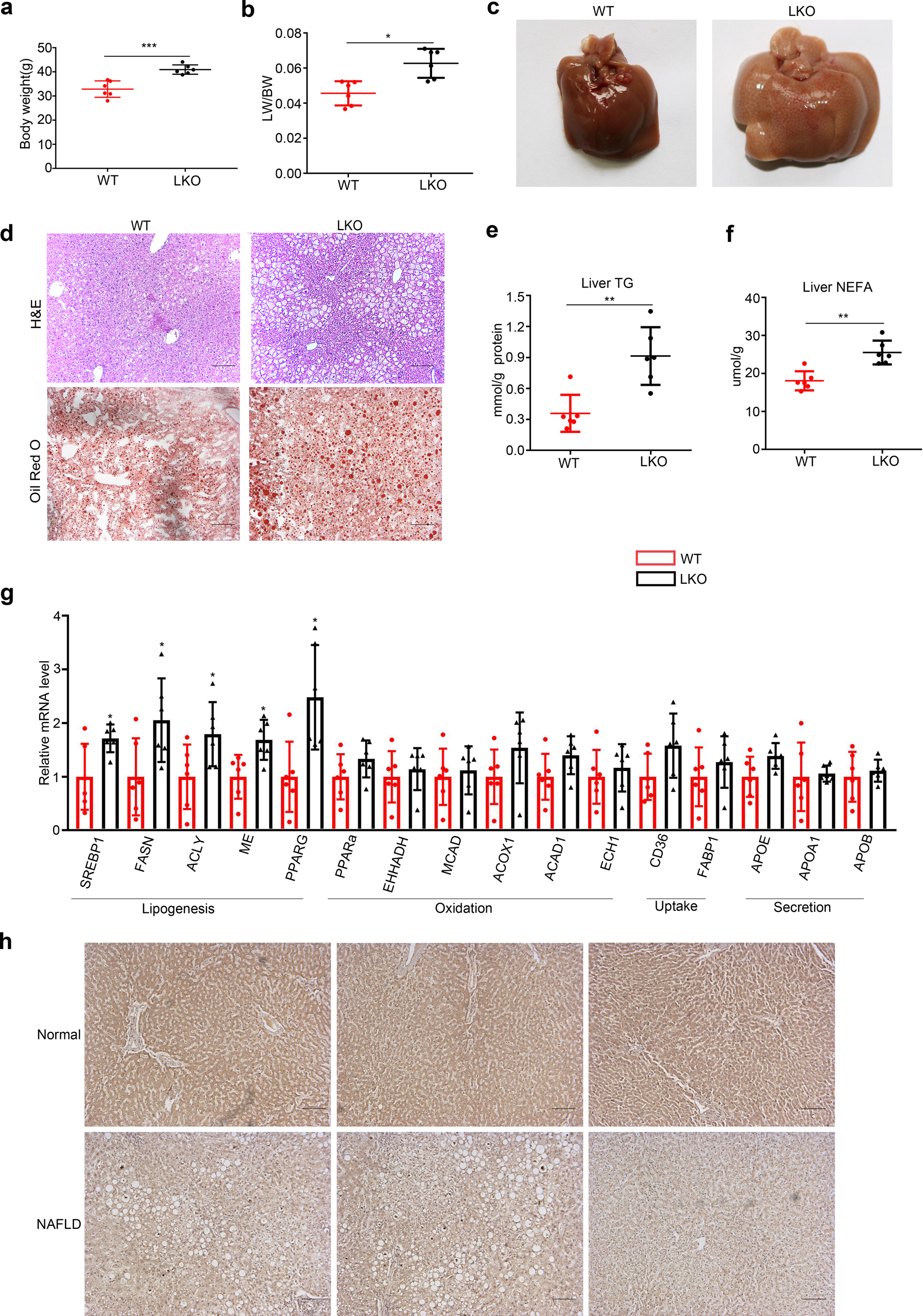 Fig. 1: Liver- specific PPDPF deficiency leads to the development of fatty liver disease.
