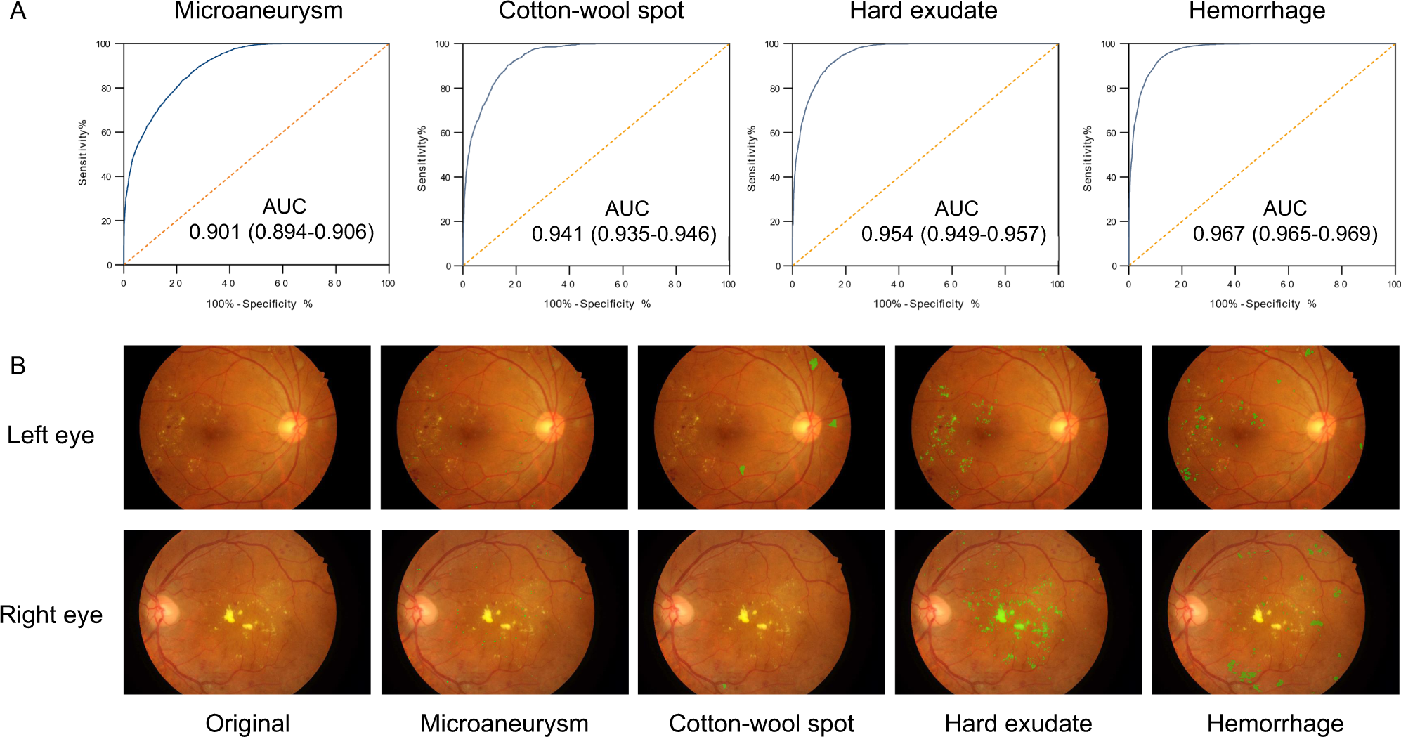 Fig. 3: Performance of the lesion-aware sub-network.