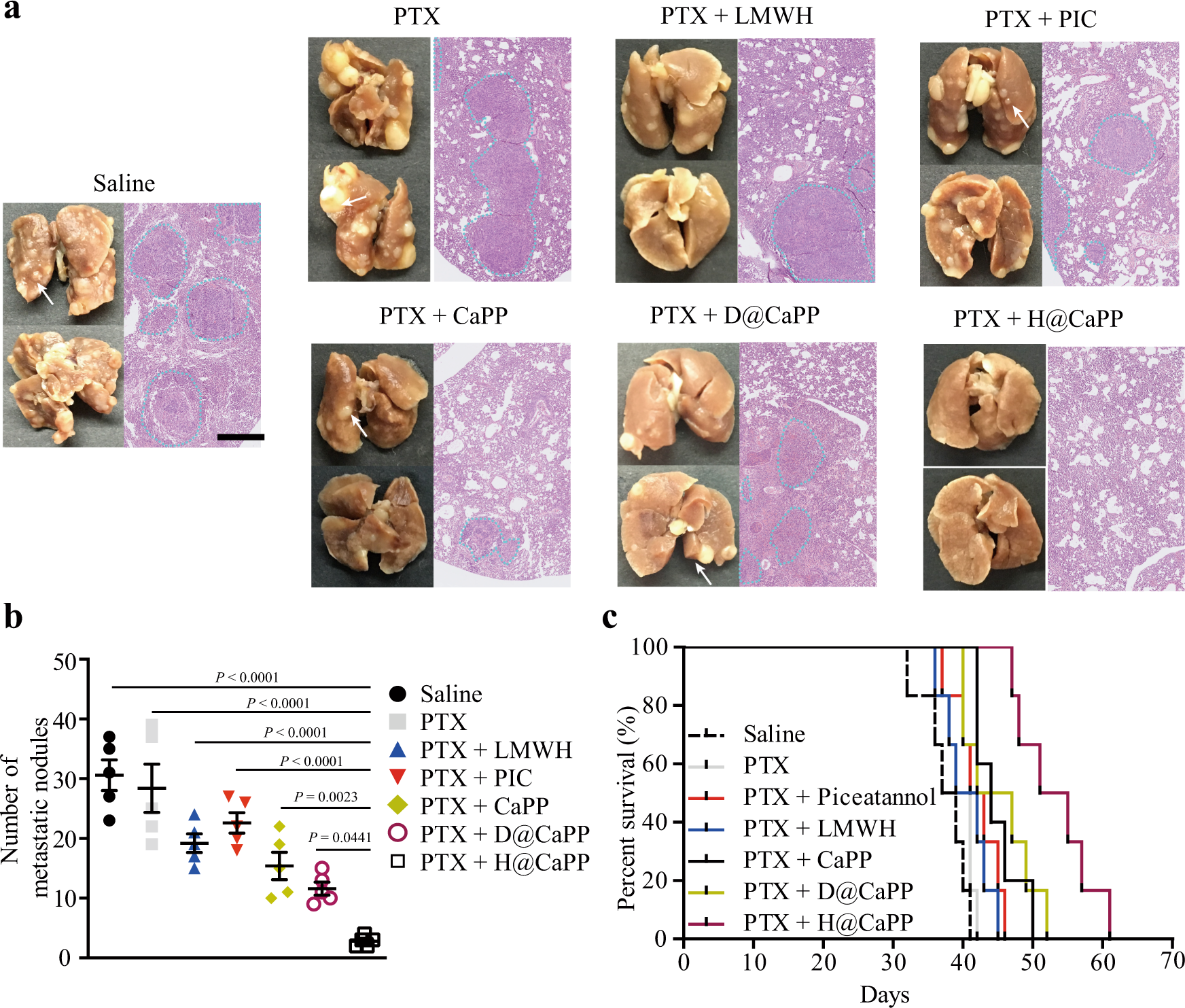 Fig. 9: H@CaPP combined with chemotherapy achieved the anti-metastasis therapeutic effect in orthotropic primary tumor-bearing mice.