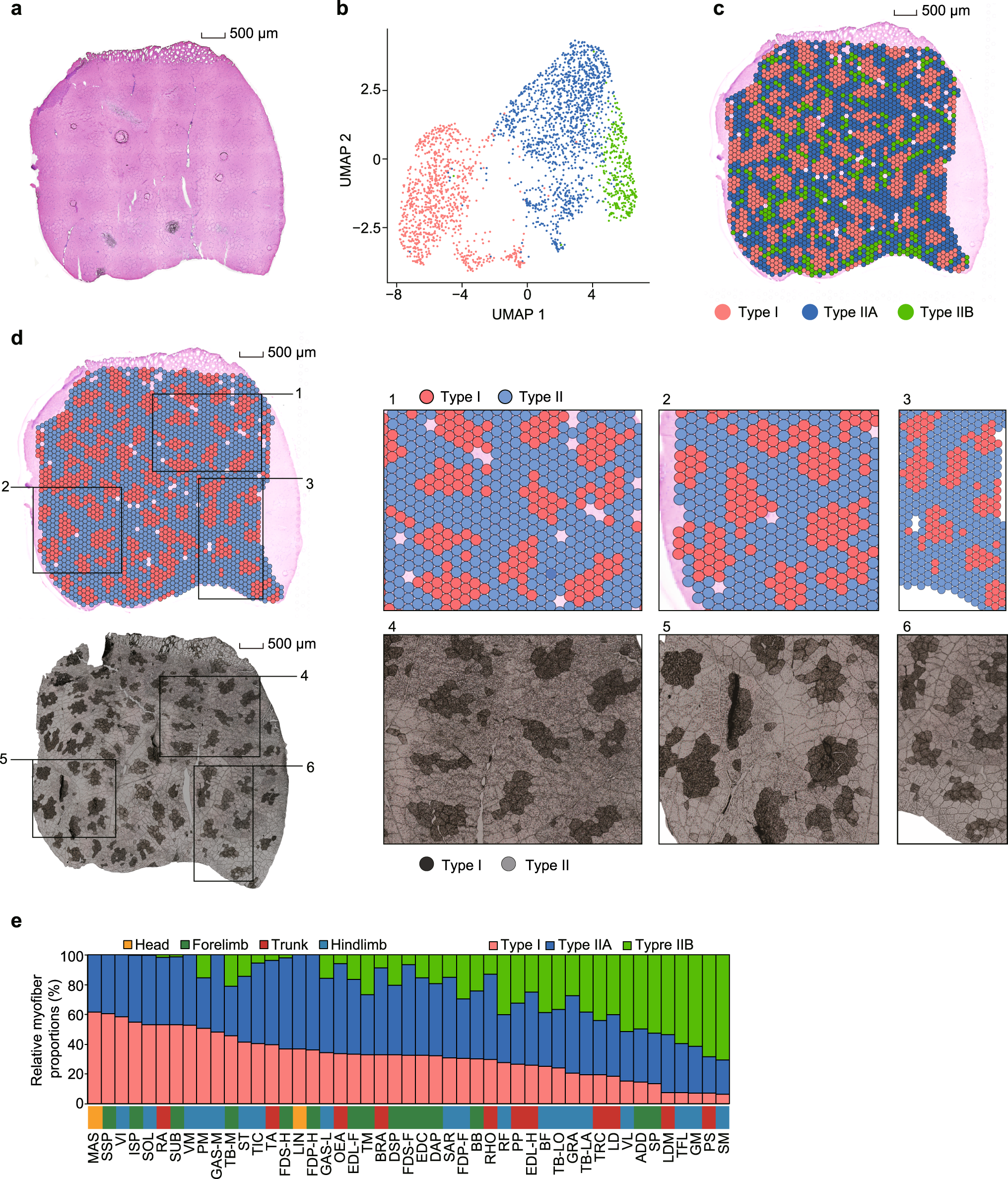 Fig. 4: Spatial transcriptomics (ST) illustrate the myofiber composition of SMTs.
