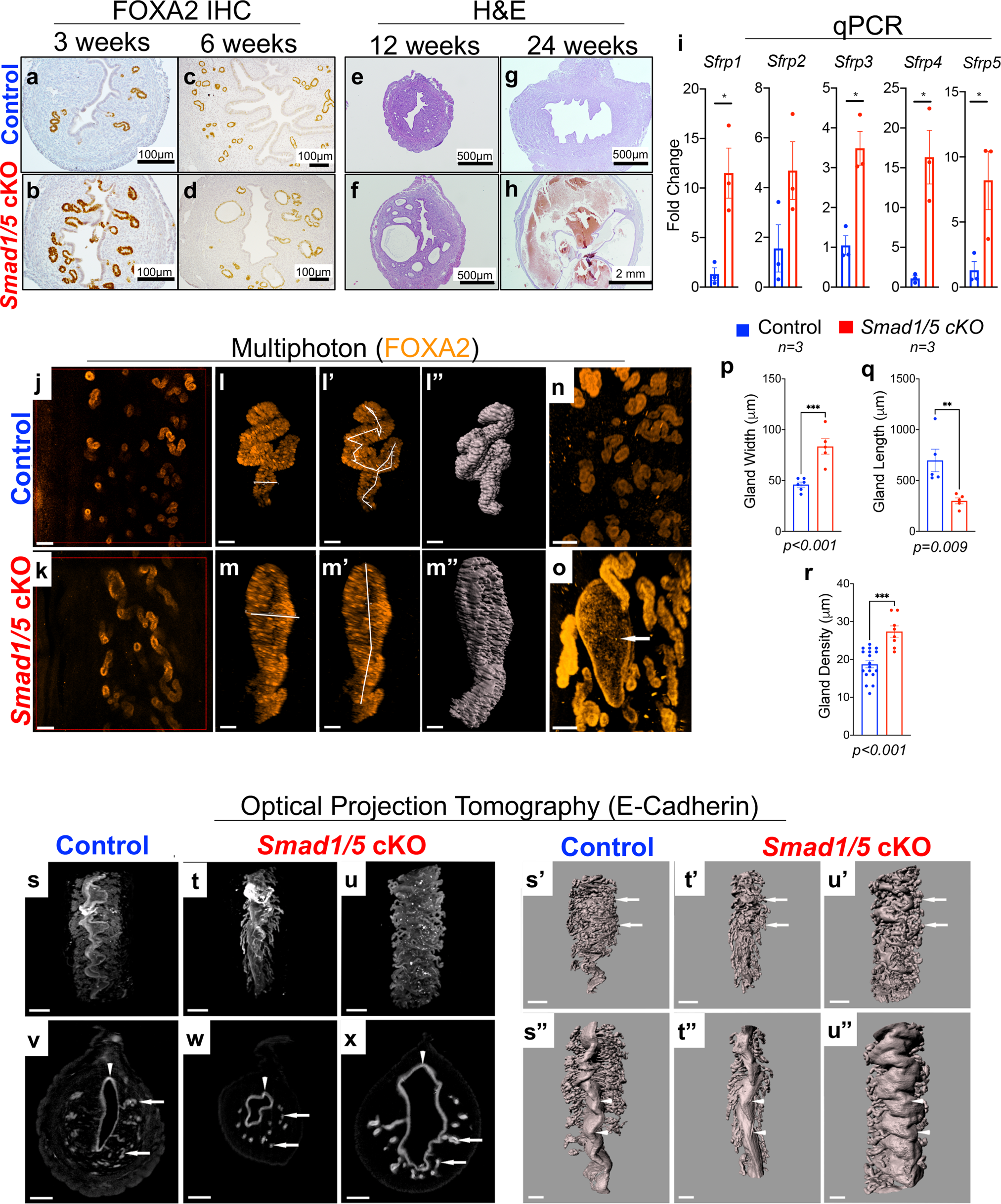 Fig. 2: Smad1/5 cKO mice develop abnormal uterine glands that appear enlarged and cystic.
