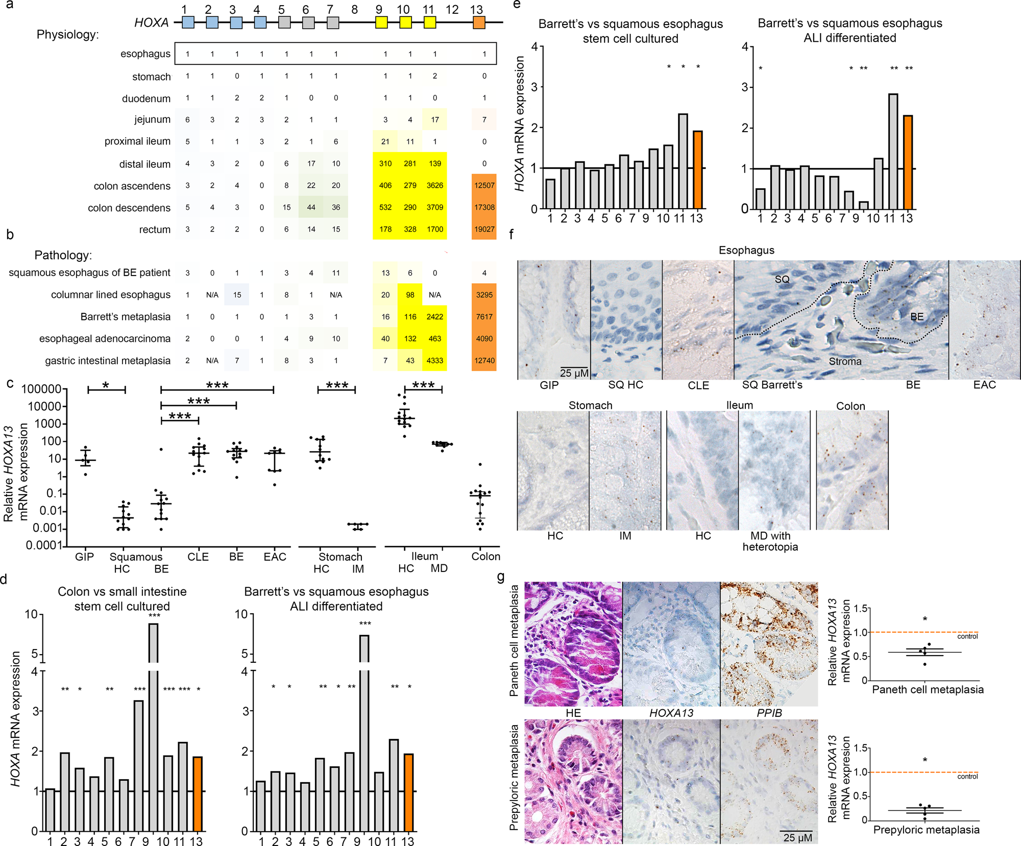 Hoxa13 In Etiology And Oncogenic Potential Of Barrett S Esophagus Nature Communications Hoxa13 In Etiology And Oncogenic Potential Of Barrett S Esophagus Nature Communications