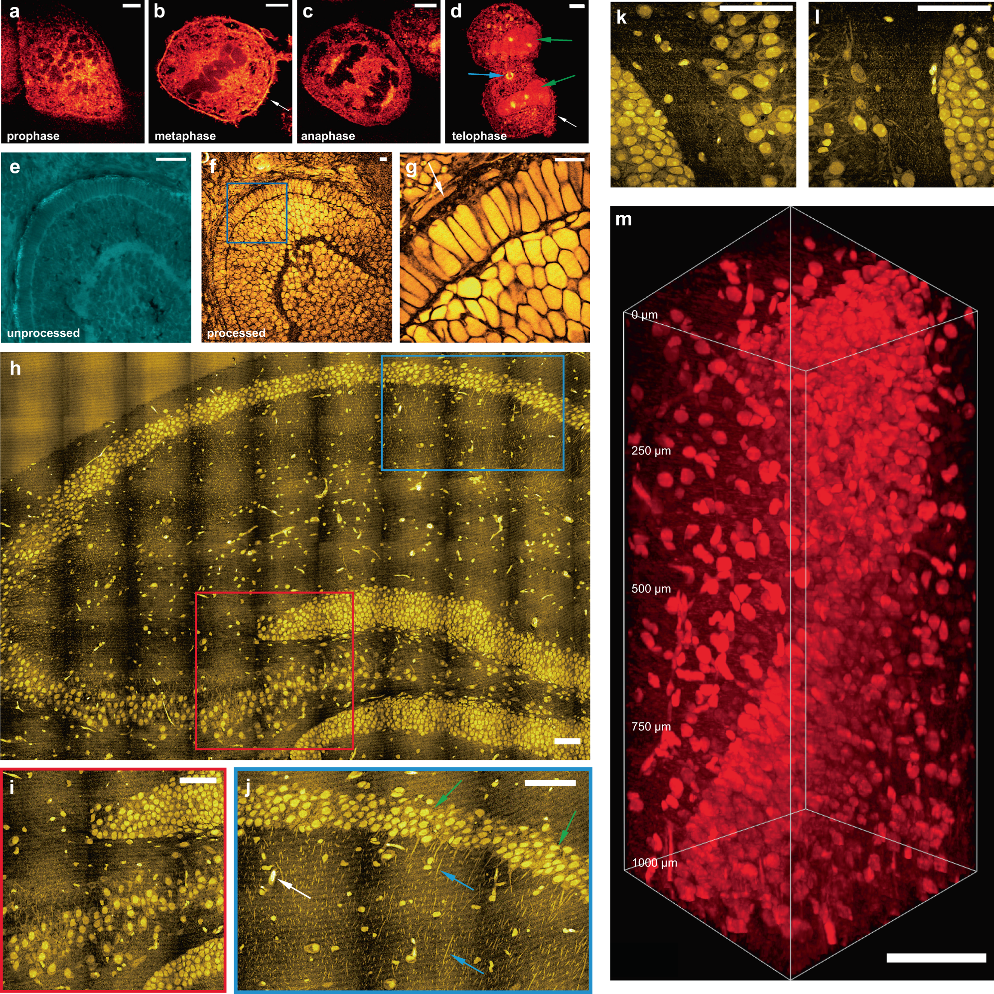 Fig. 2: Super-resolution three-dimensional VISTA imaging of cells and tissues.