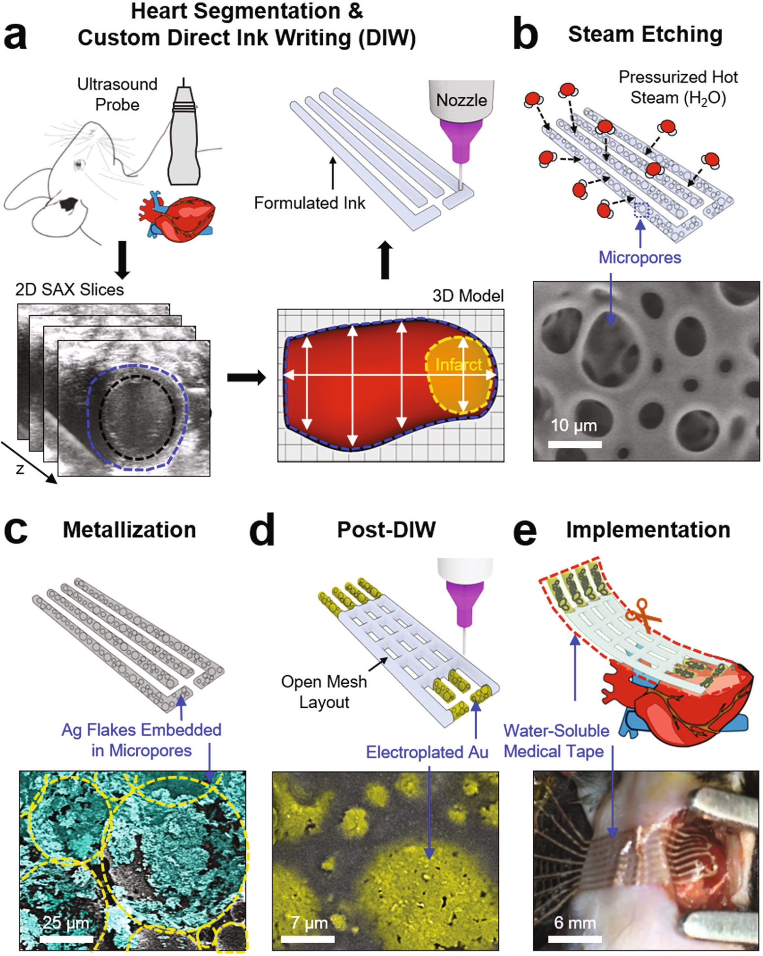 Rapid custom prototyping of soft poroelastic biosensor for simultaneous  epicardial recording and imaging | Nature Communications