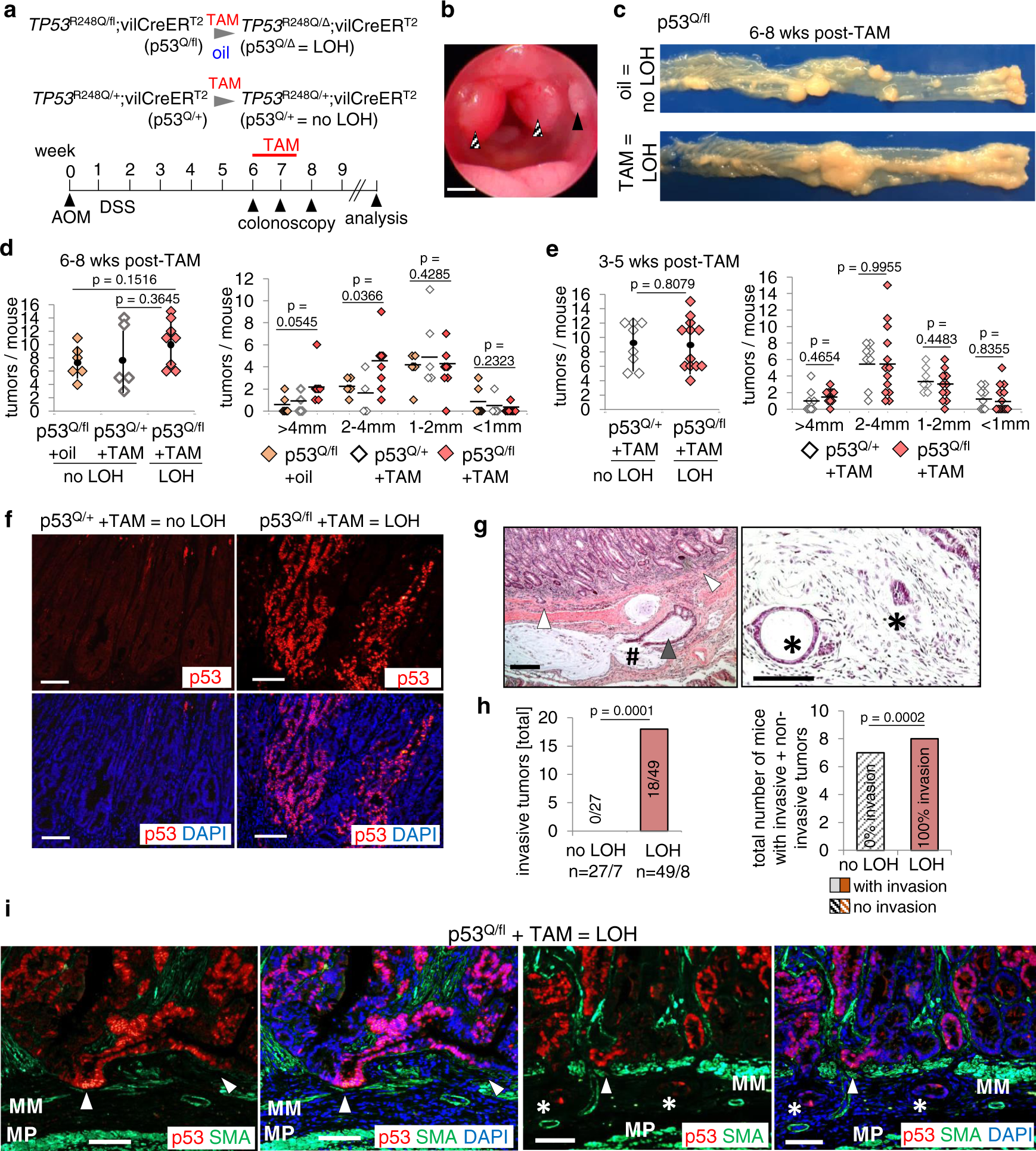 Suppression of HSF1 activity by wildtype p53 creates a driving force for  p53 loss-of-heterozygosity | Nature Communications