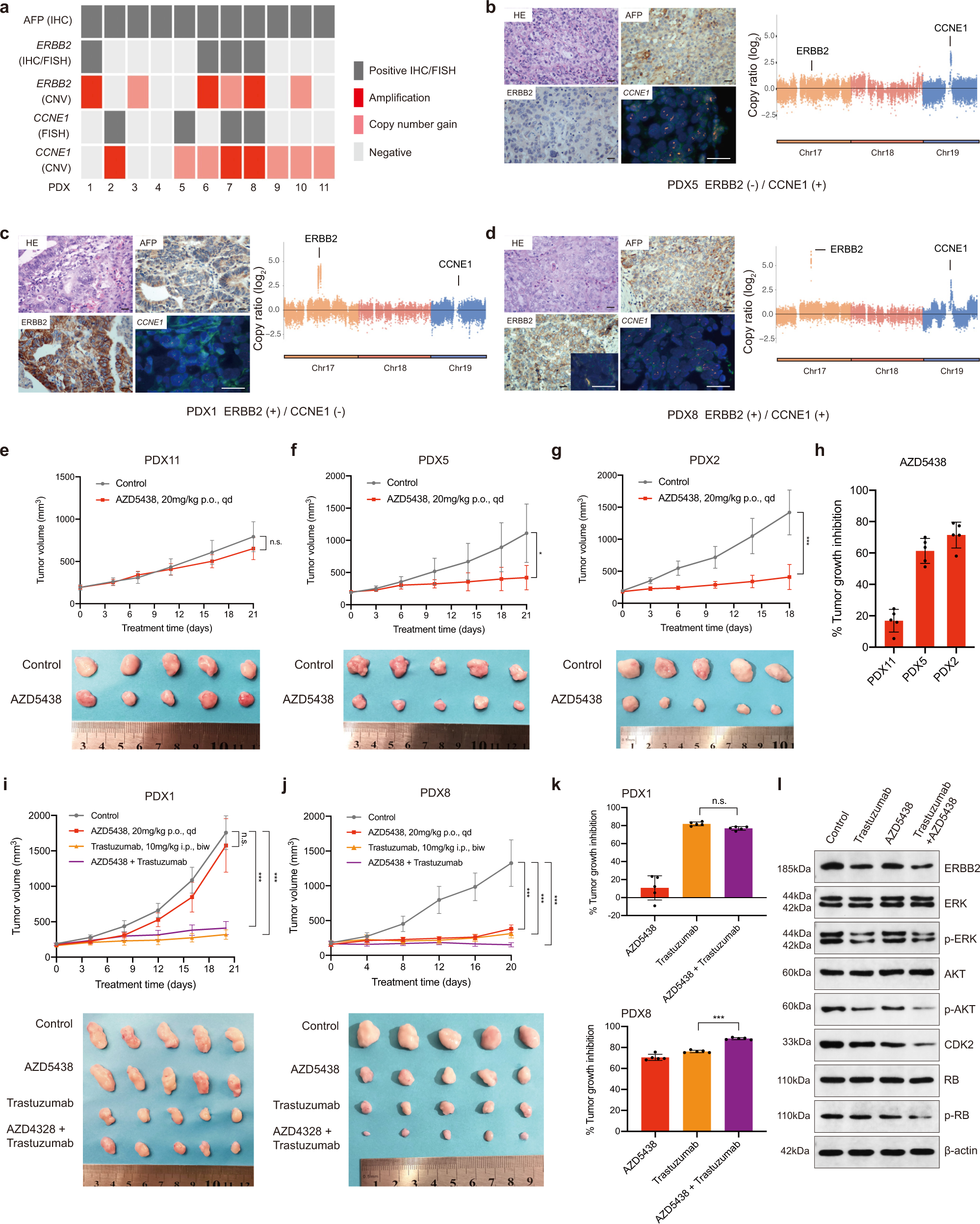 Fig. 5: Validation of selected genes as potential therapeutic targets in PDX models of AFPGC.