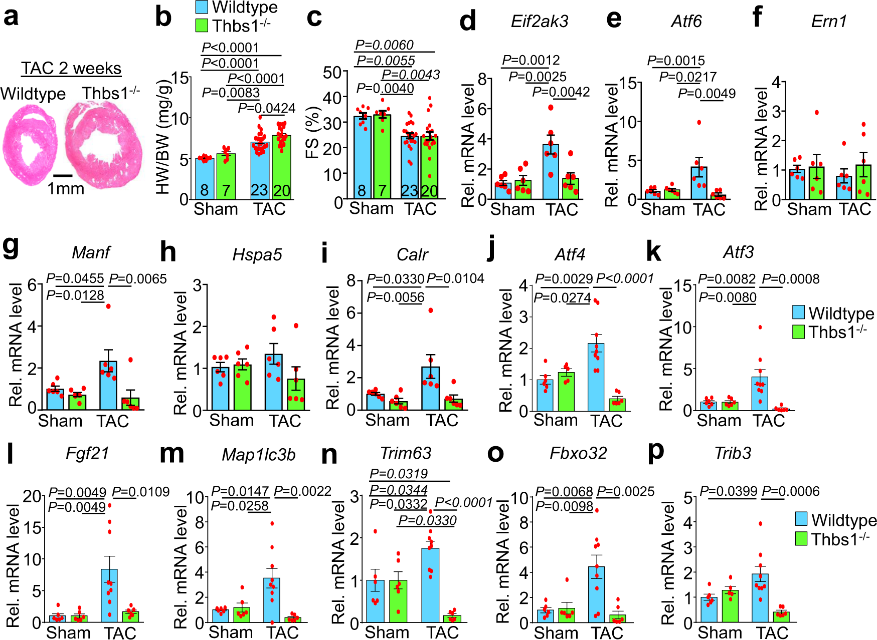 Fig. 6: Loss of Thbs1 augments hypertrophic growth and restricts atrophy in the heart.