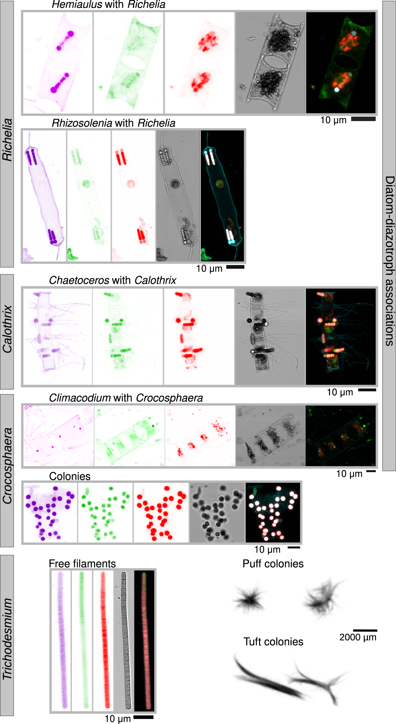 Fig. 1: Imaging observations of diazotrophs in Tara Oceans samples.